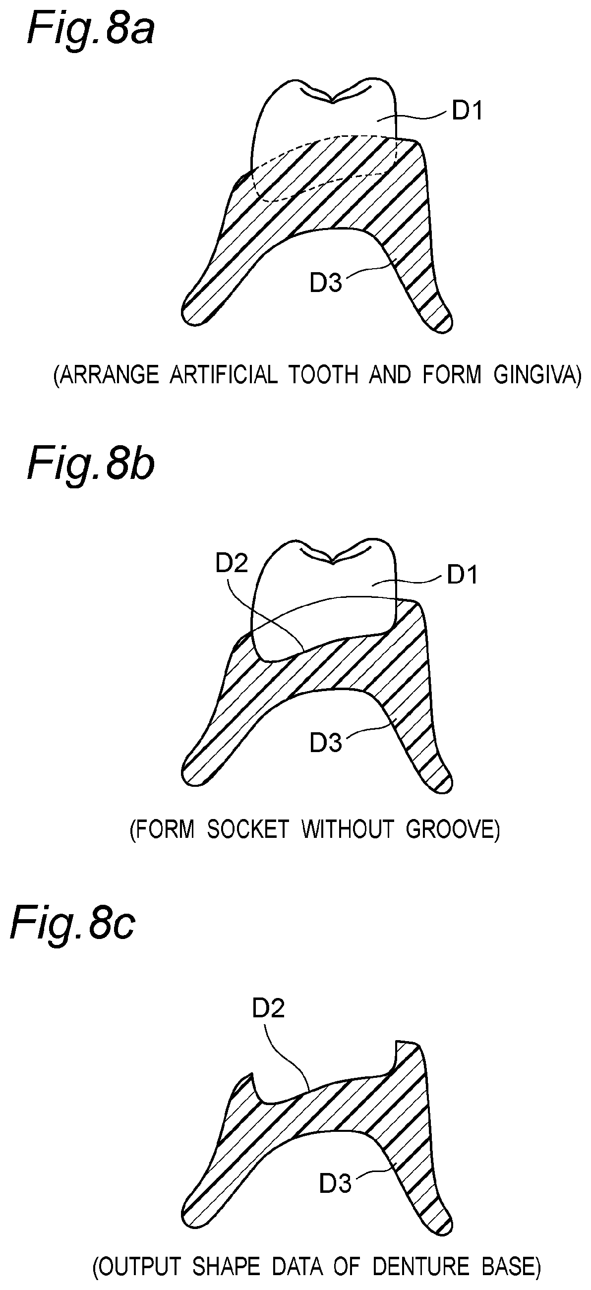 Patent US11793614 Figure 9 – Method for producing denture with high accuracy of fitting of artificial tooth to socket