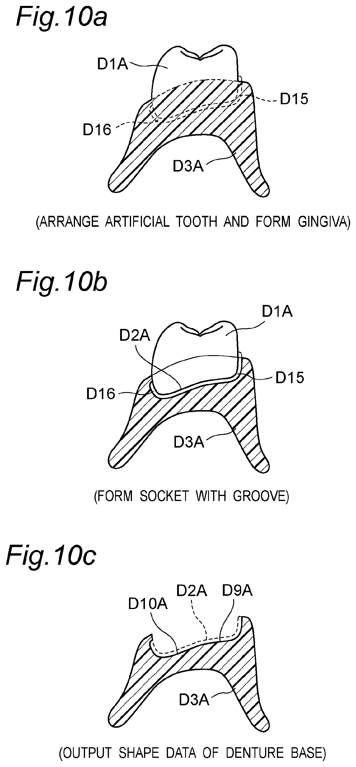 Patent US11793614 Figure 13 – Method for producing denture with high accuracy of fitting of artificial tooth to socket