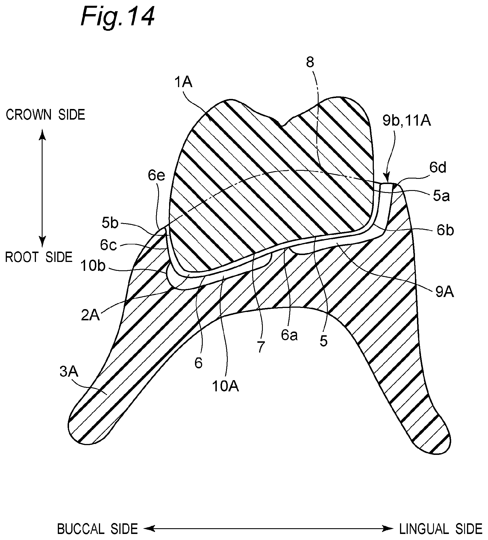 Patent US11793614 Figure 18 – Method for producing denture with high accuracy of fitting of artificial tooth to socket