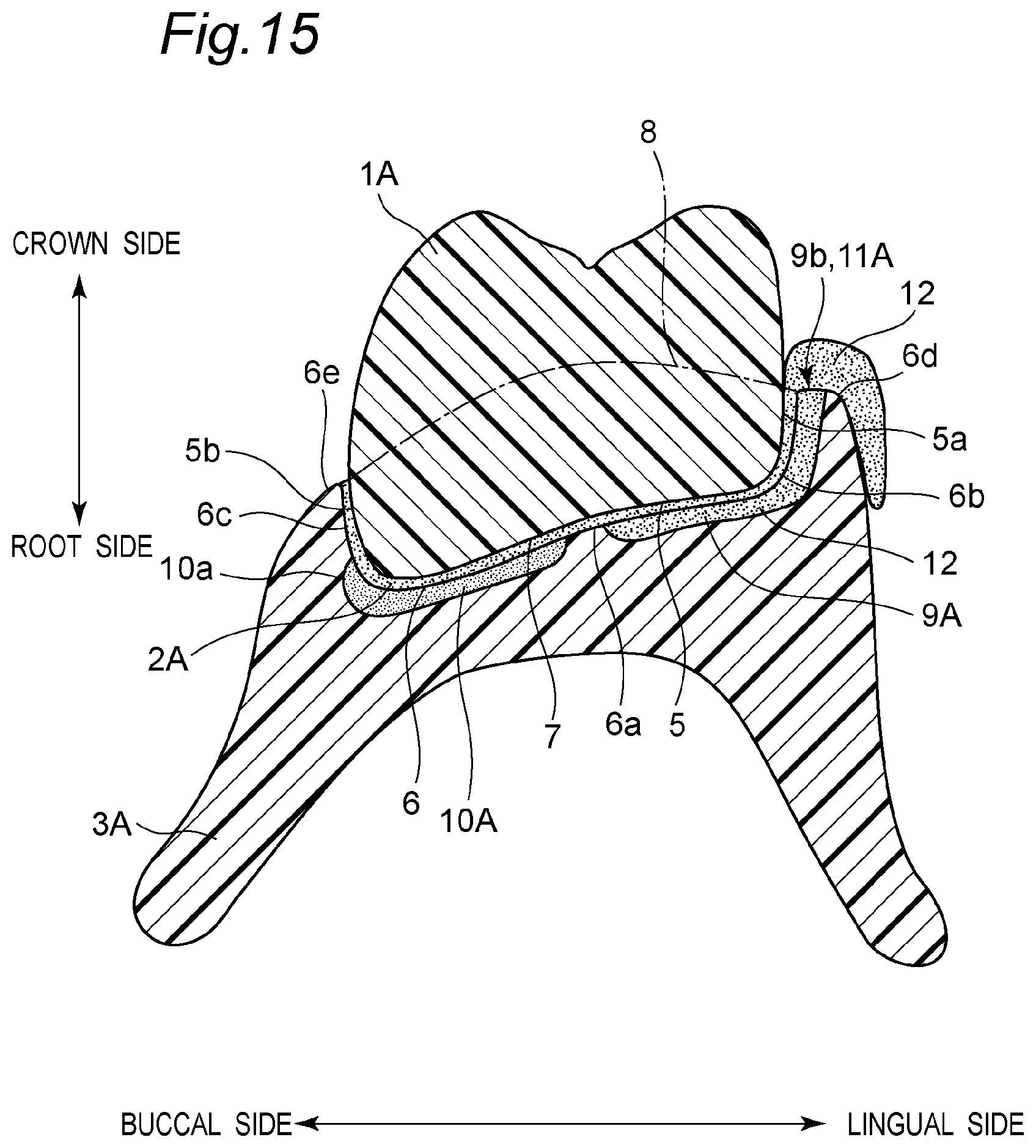 Patent US11793614 Figure 19 – Method for producing denture with high accuracy of fitting of artificial tooth to socket