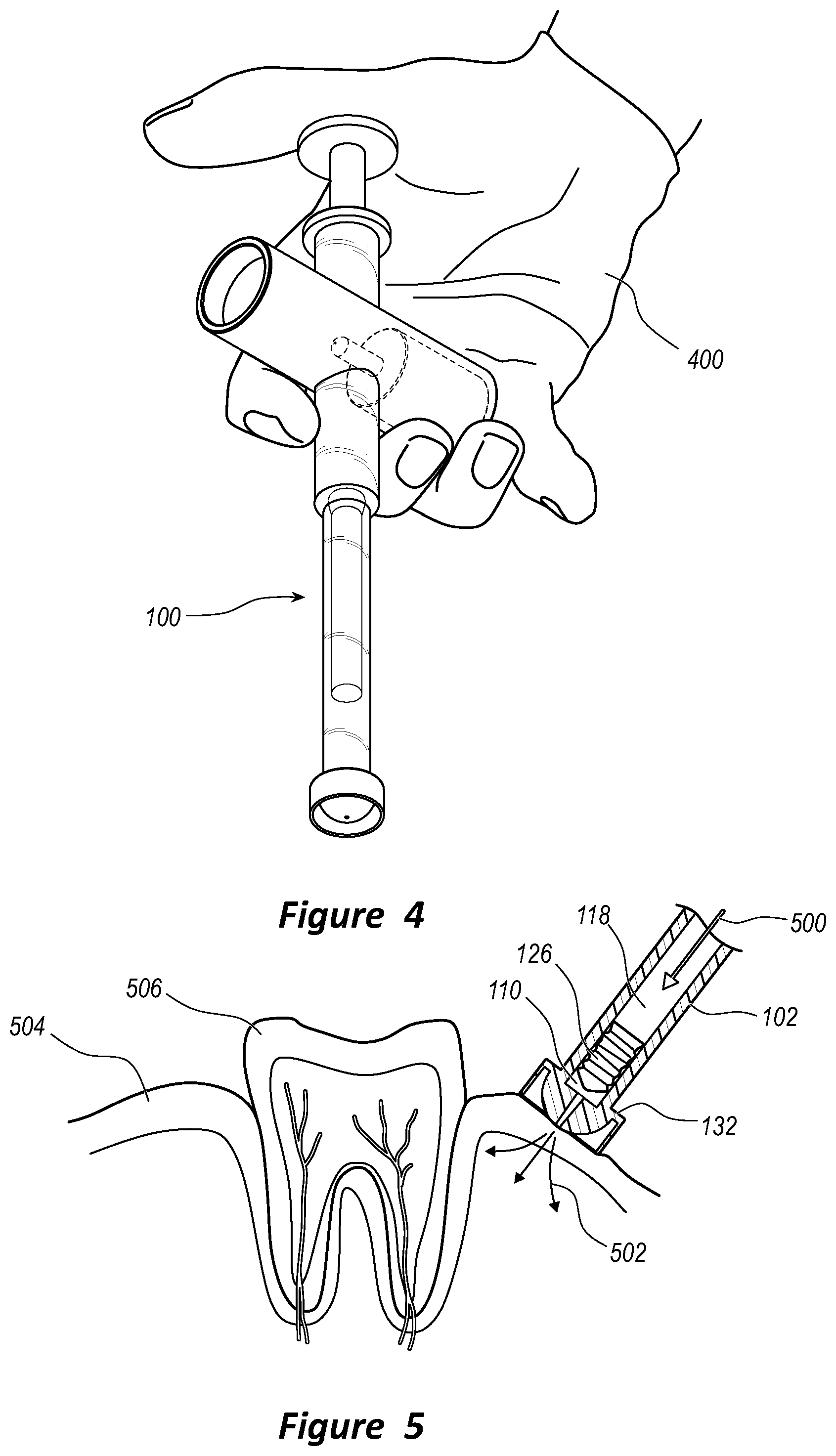 Patent US11793621 Figure 4 – Dental anesthetic delivery devices and associated methods