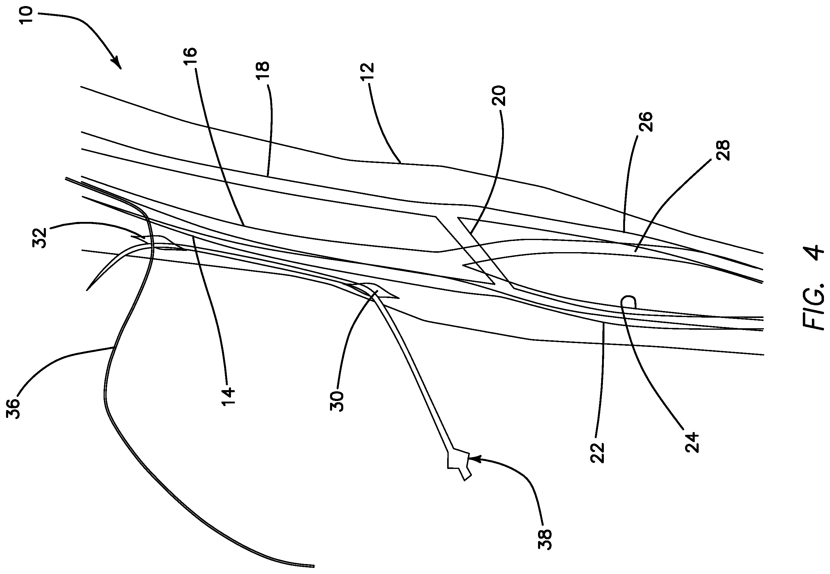 Patent US11793623 Figure 3 – Systems and methods for percutaneously placing biologic grafts at a procedural site