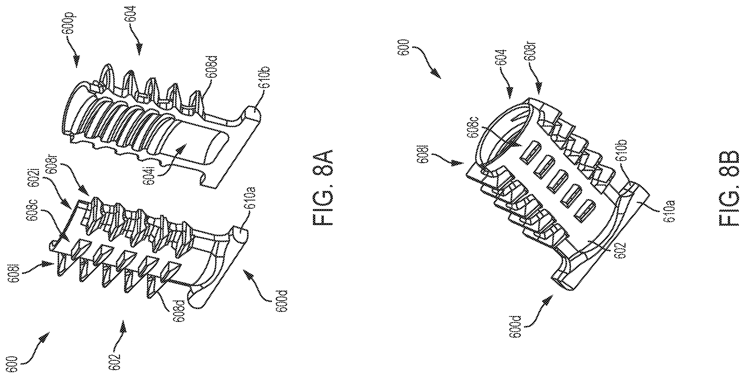 Patent US11793624 Figure 13 – Tenodesis implants and tools