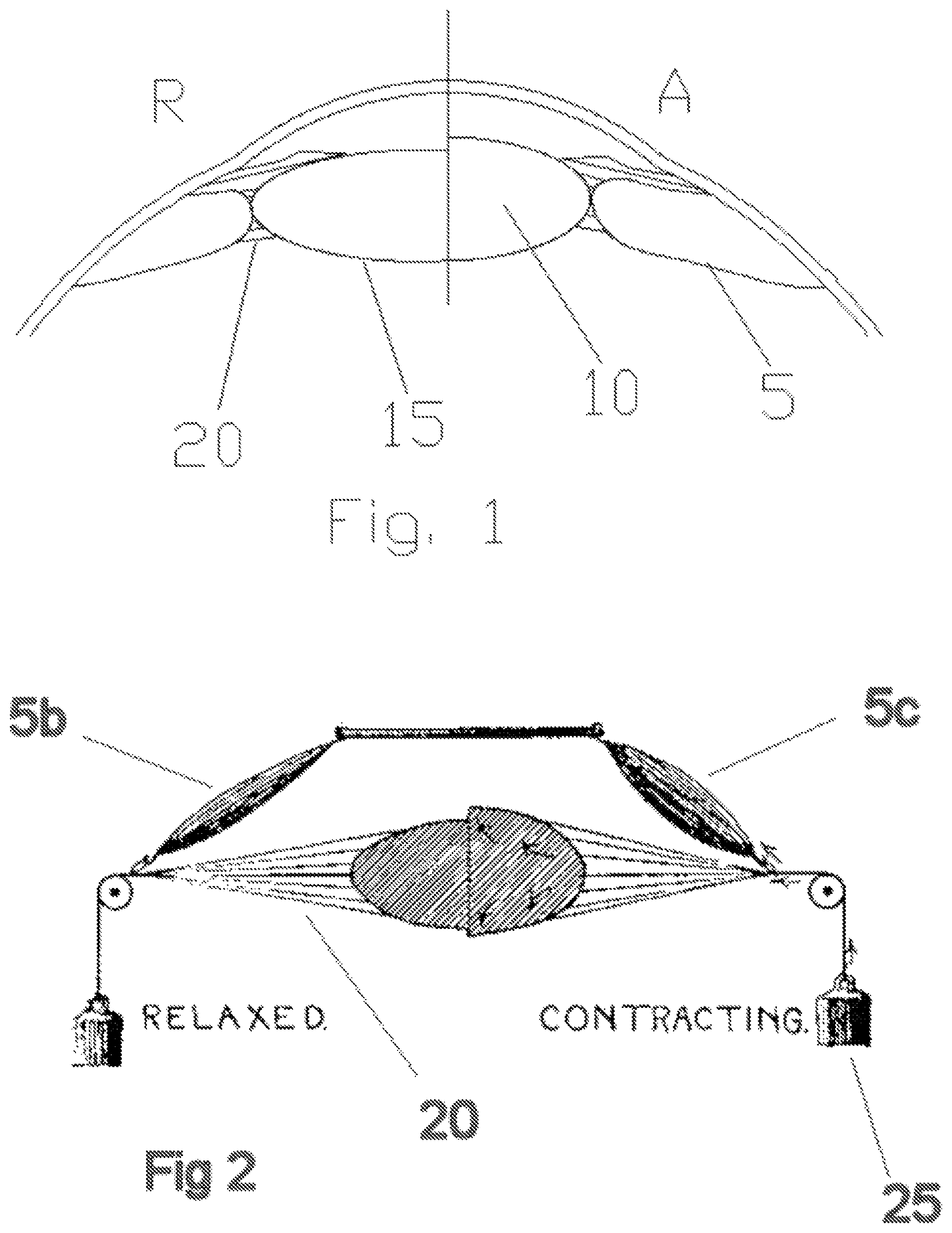 Patent US11793625 Figure 1 – Systems, devices, and/or methods for managing implantable devices