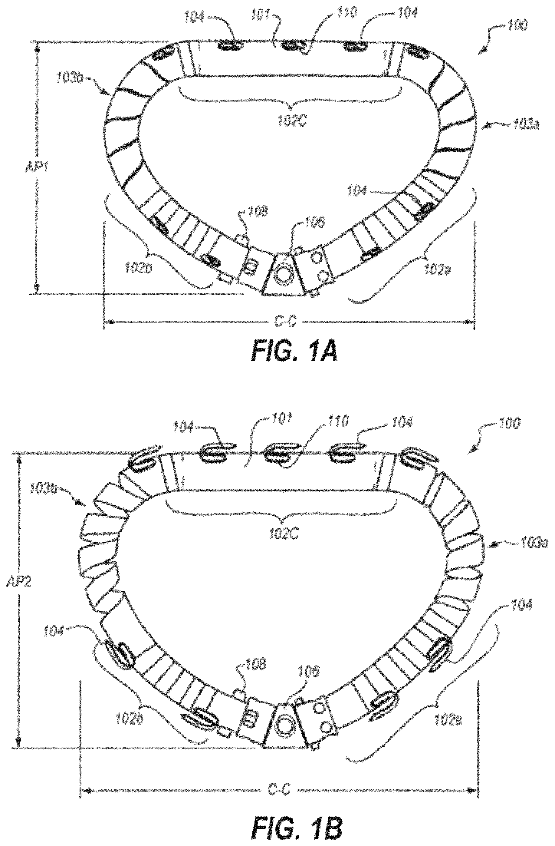 Patent US11793628 Figure 1 – Transcatheter bio-prosthesis member and support structure