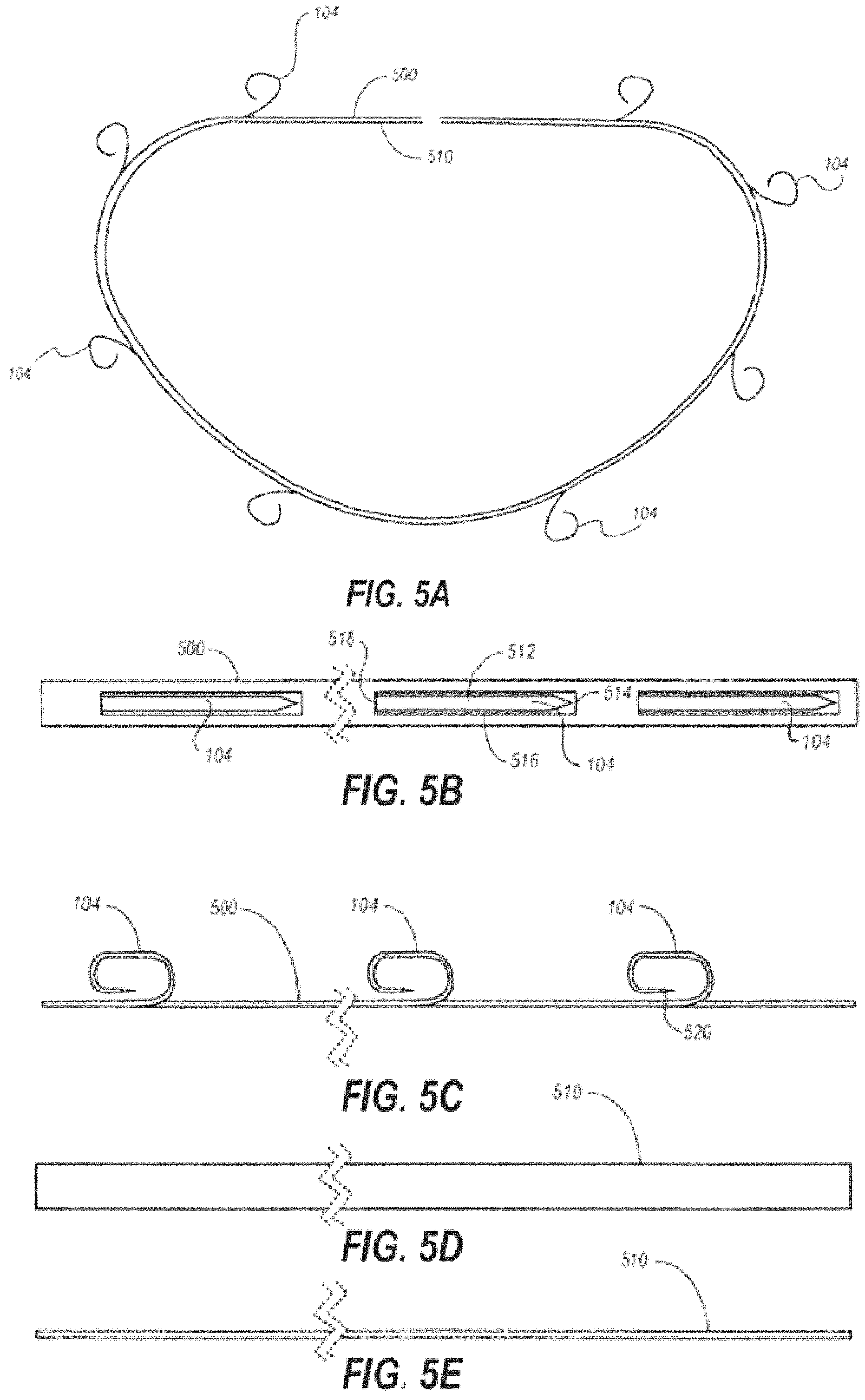 Patent US11793628 Figure 6 – Transcatheter bio-prosthesis member and support structure
