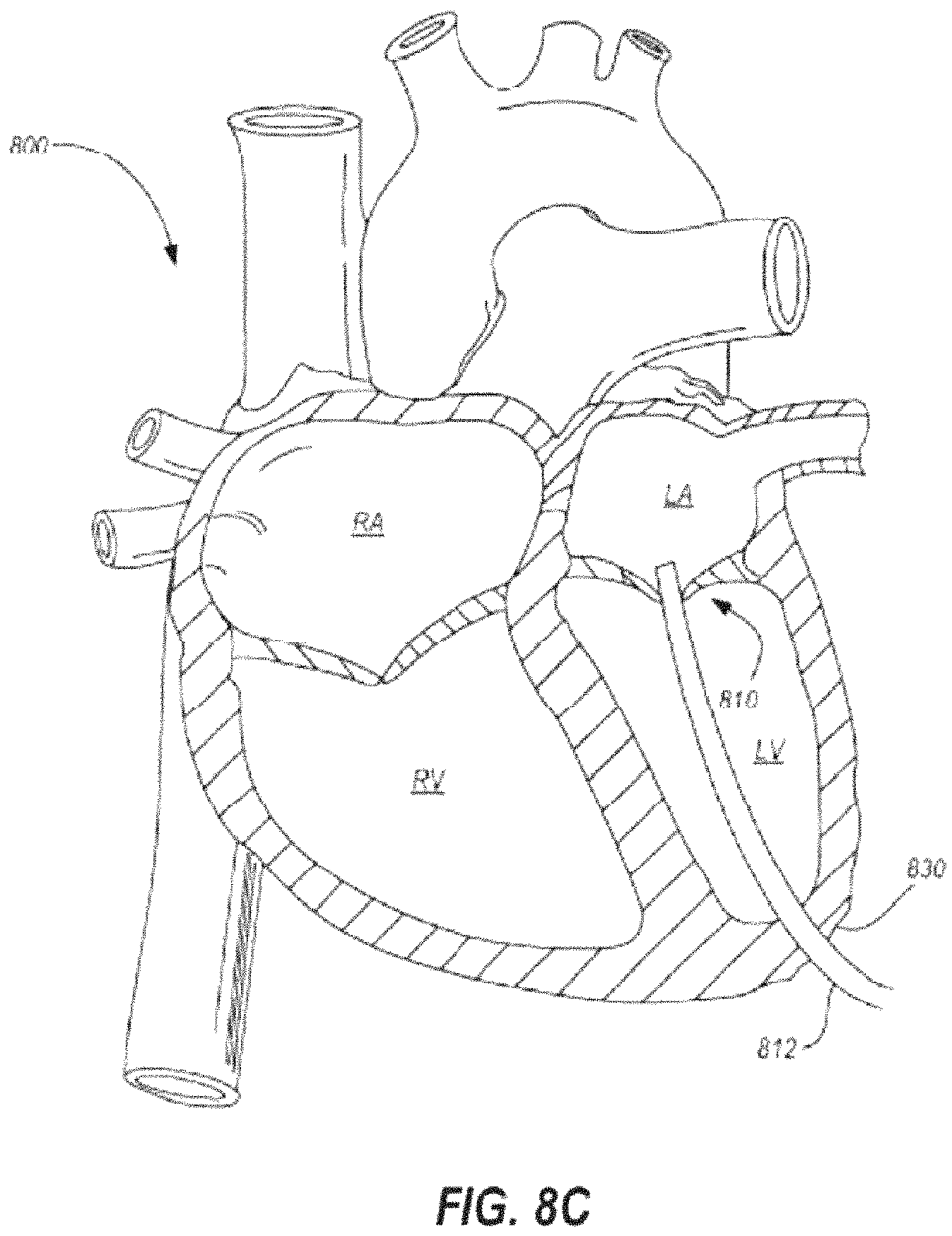 Patent US11793628 Figure 13 – Transcatheter bio-prosthesis member and support structure