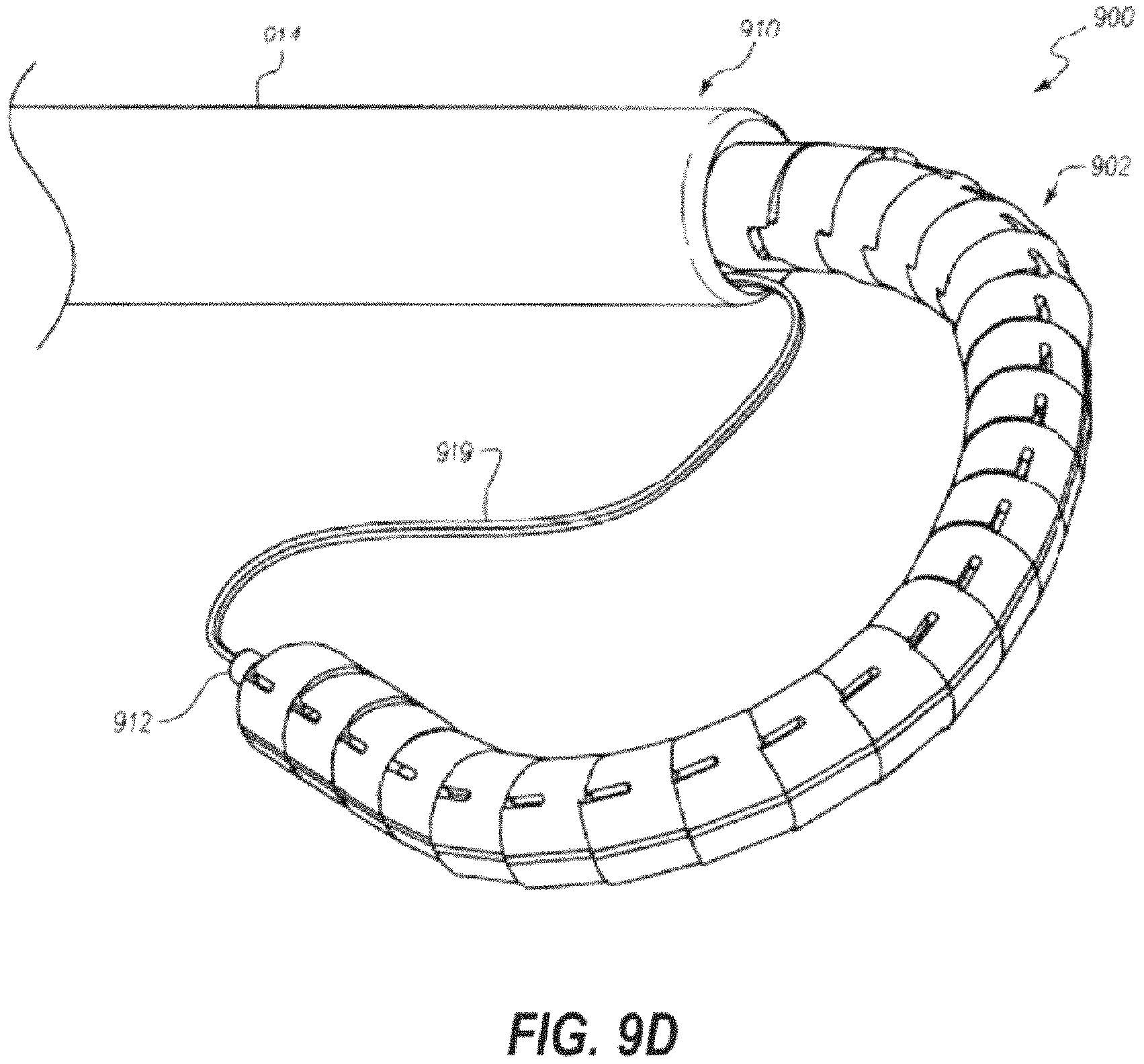 Patent US11793628 Figure 17 – Transcatheter bio-prosthesis member and support structure