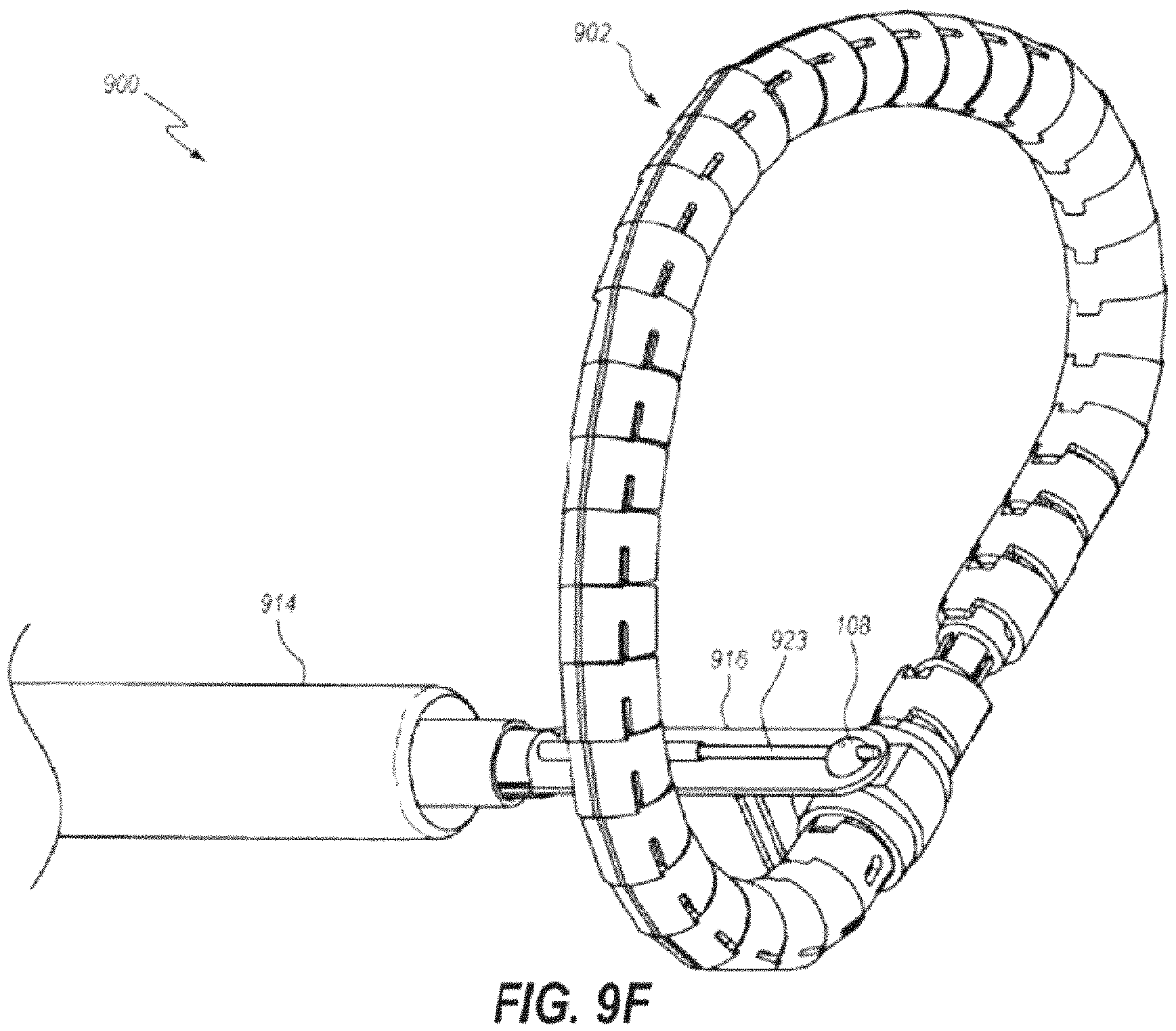Patent US11793628 Figure 19 – Transcatheter bio-prosthesis member and support structure