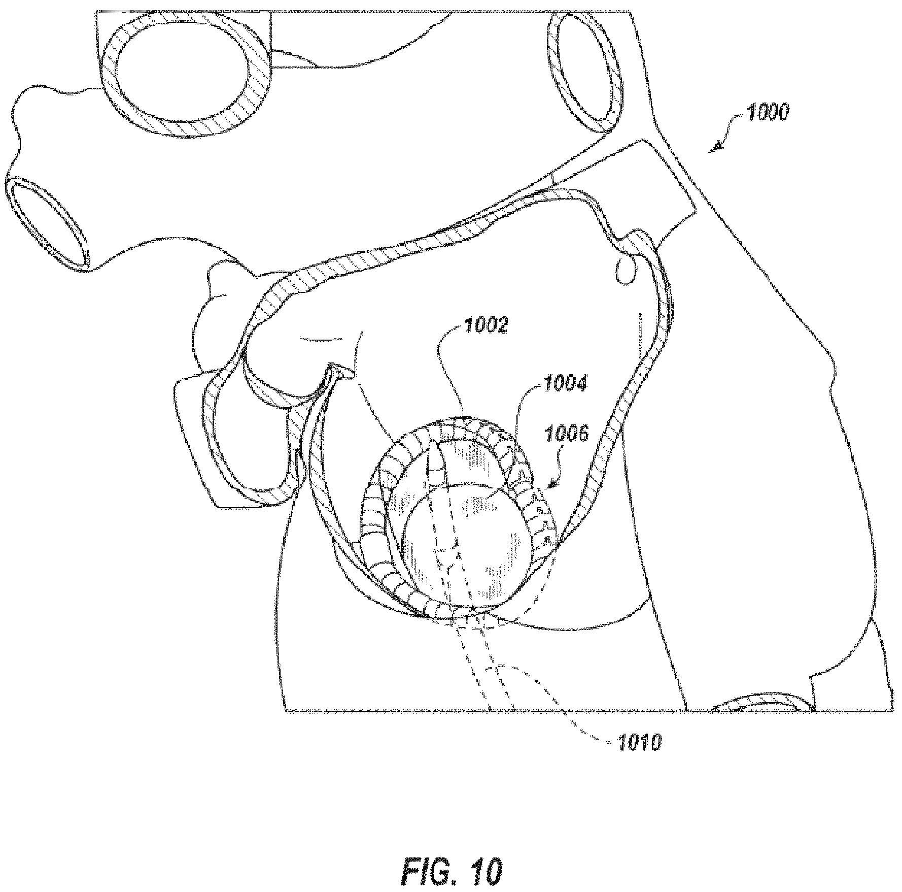Patent US11793628 Figure 20 – Transcatheter bio-prosthesis member and support structure