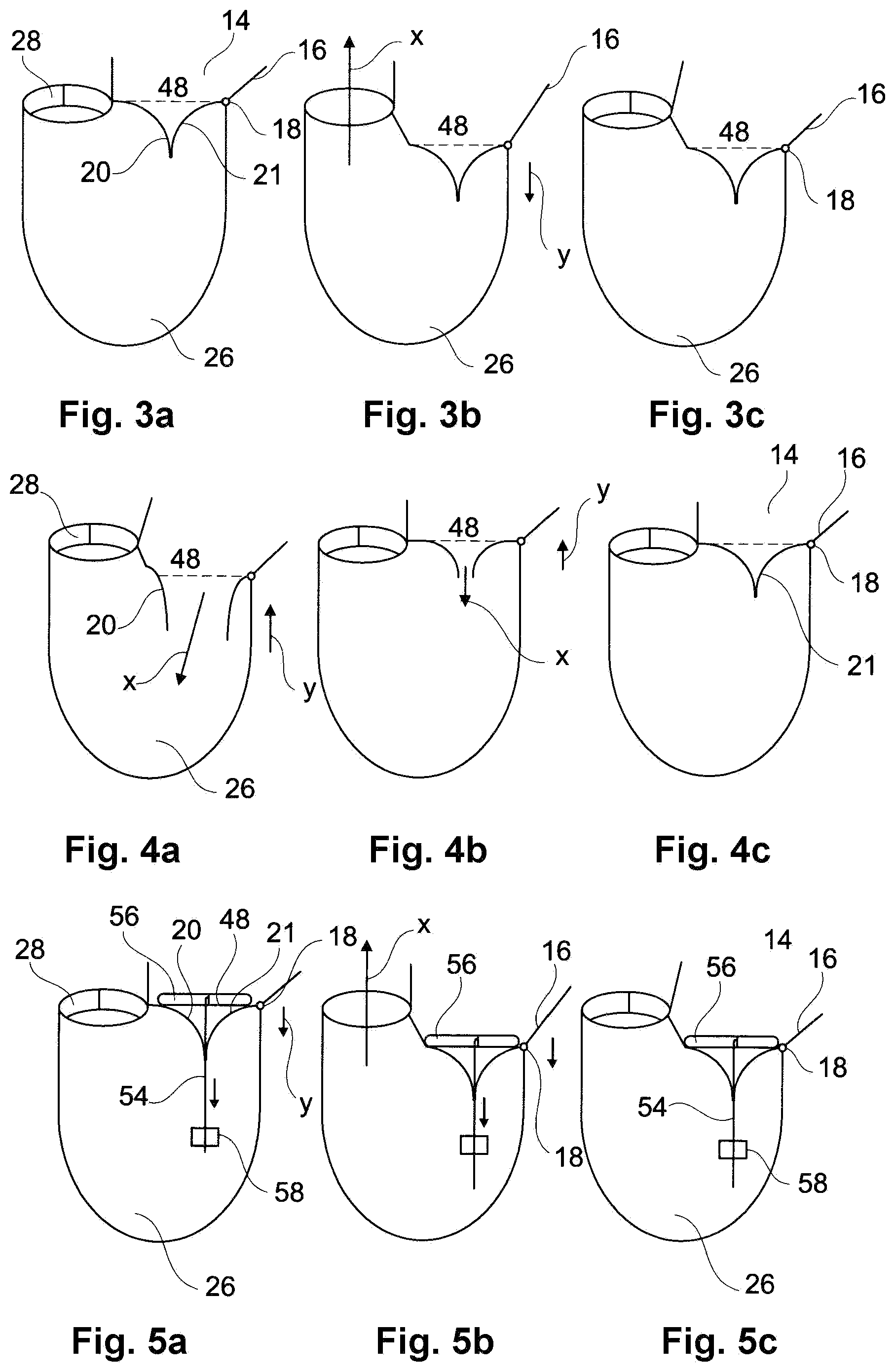 Patent US11793629 Figure 2 – Device and a method for augmenting heart function