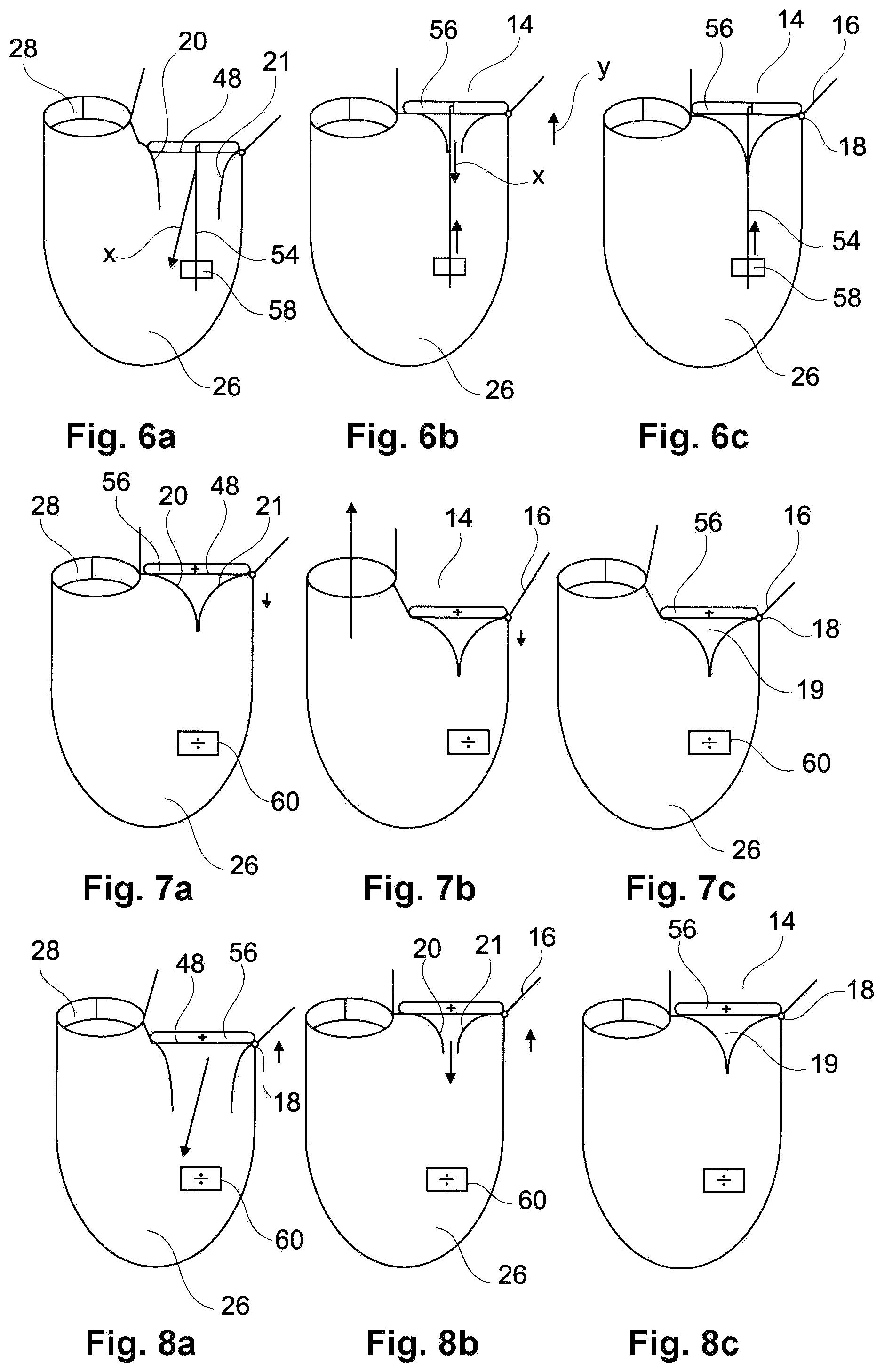 Patent US11793629 Figure 3 – Device and a method for augmenting heart function