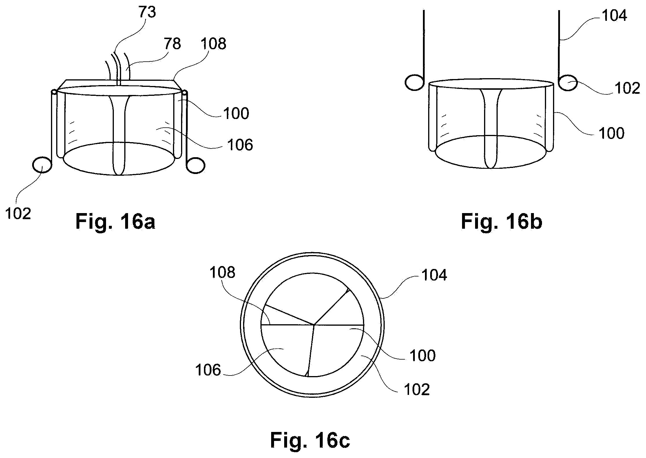 Patent US11793629 Figure 10 – Device and a method for augmenting heart function