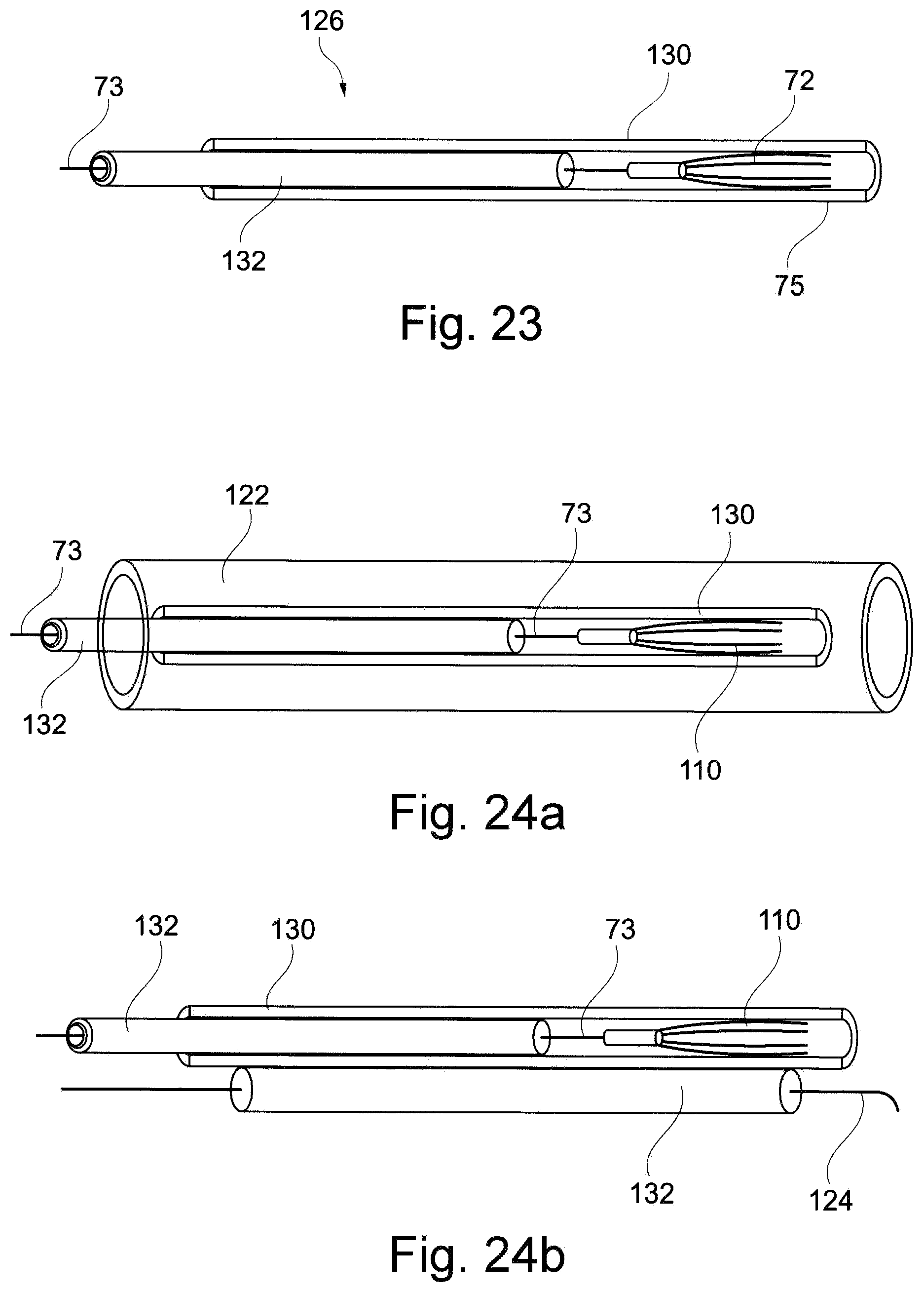 Patent US11793629 Figure 15 – Device and a method for augmenting heart function