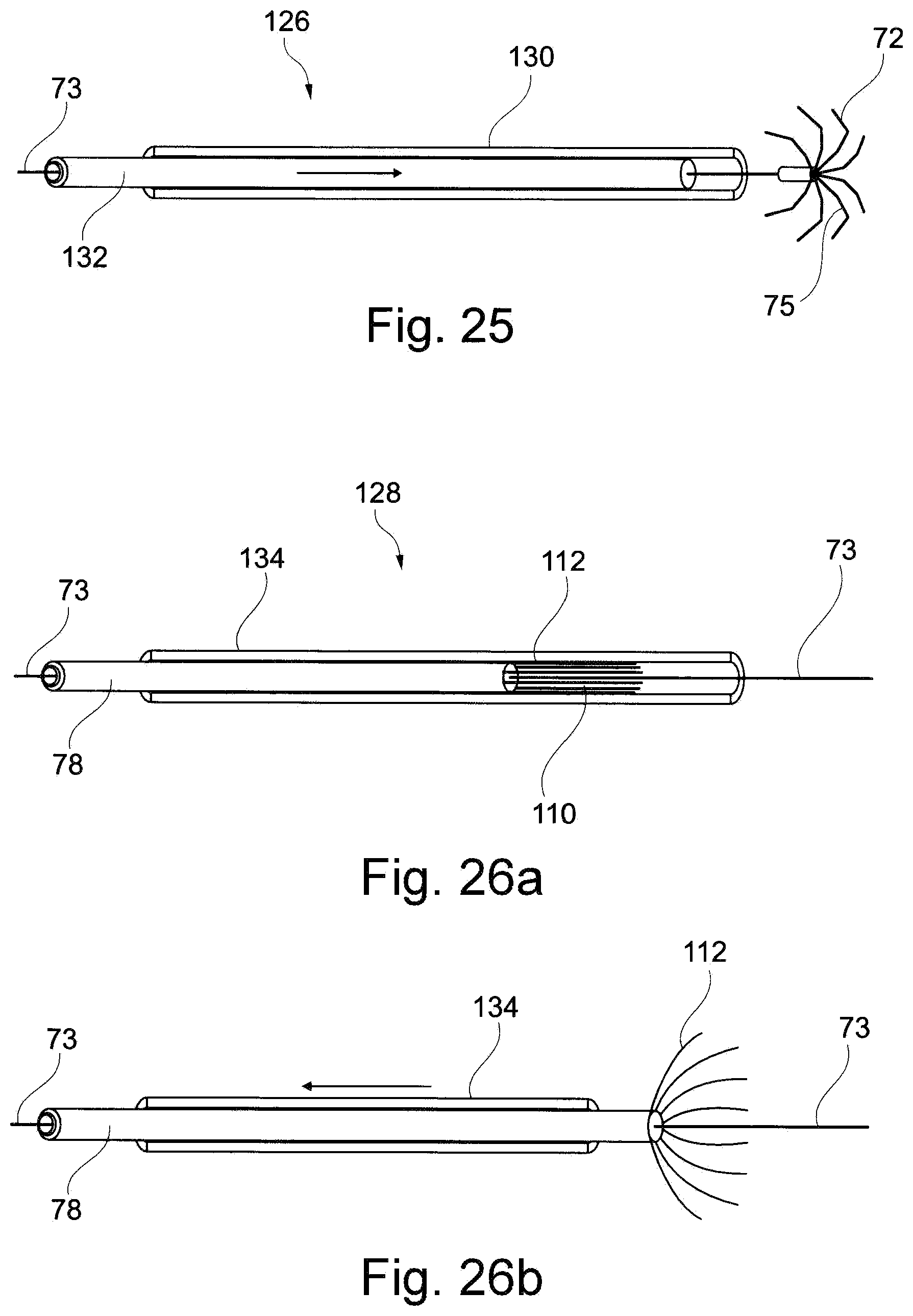 Patent US11793629 Figure 16 – Device and a method for augmenting heart function