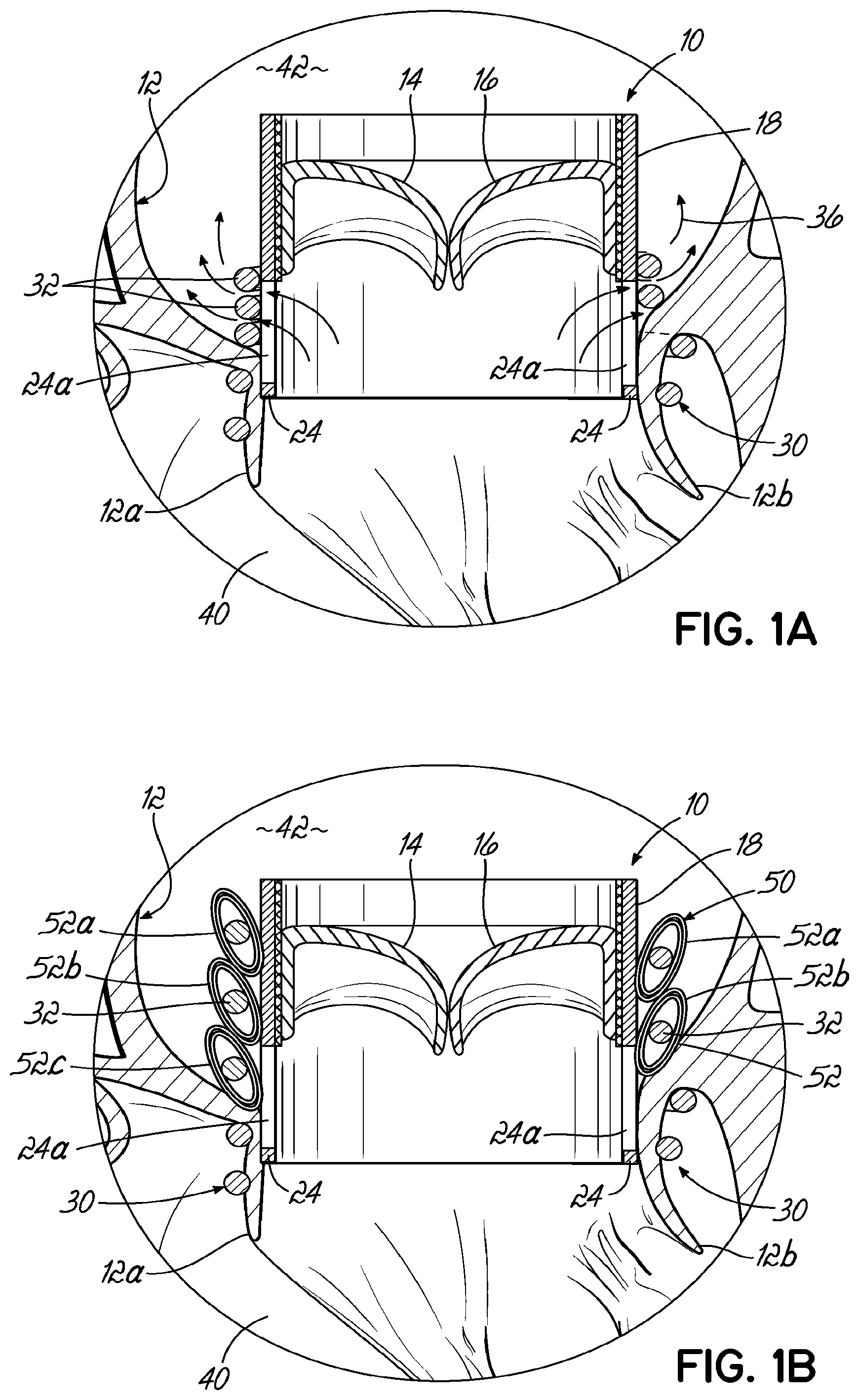 Patent US11793630 Figure 1 – Apparatus and methods for implanting a replacement heart valve