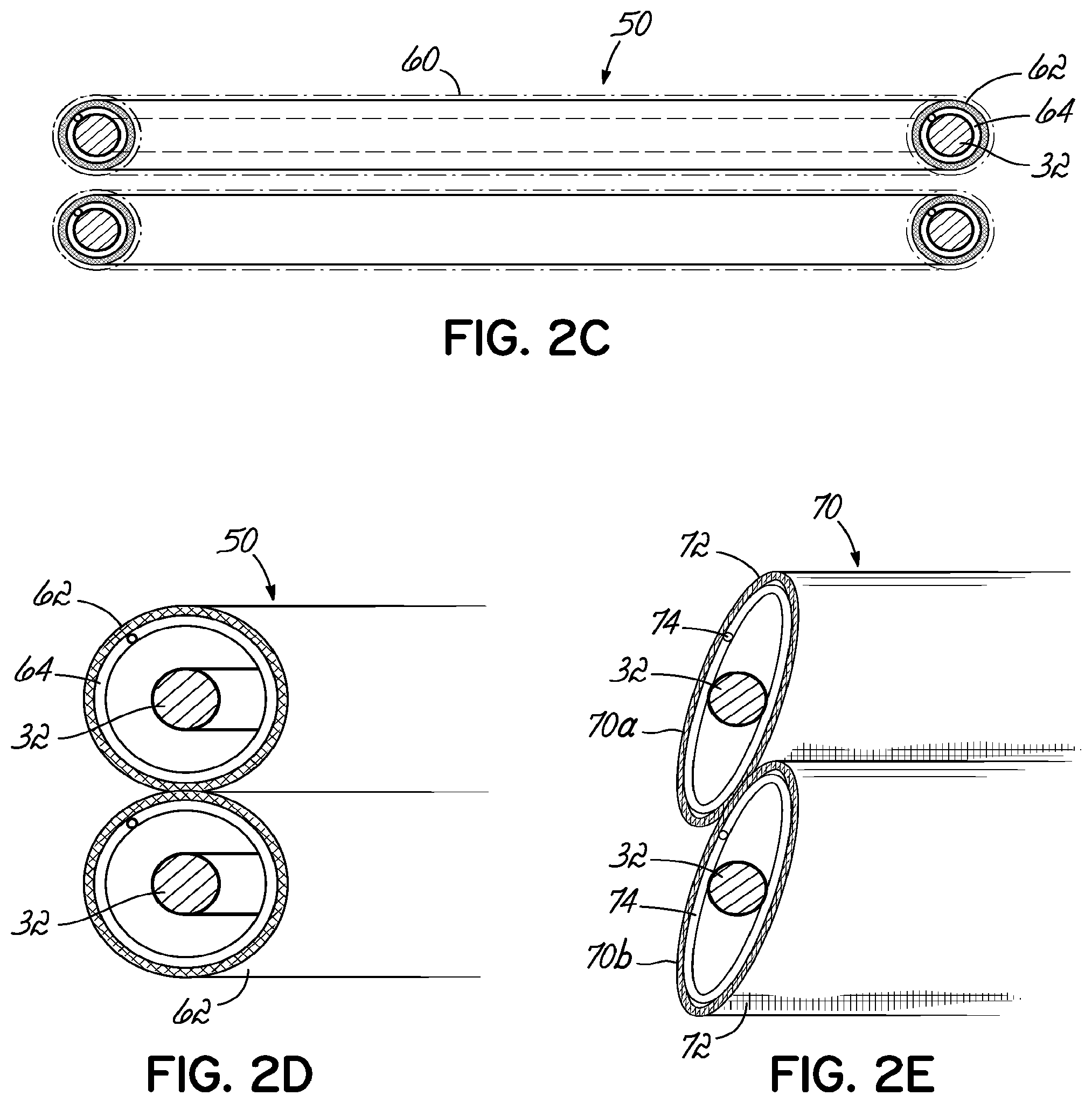 Patent US11793630 Figure 3 – Apparatus and methods for implanting a replacement heart valve