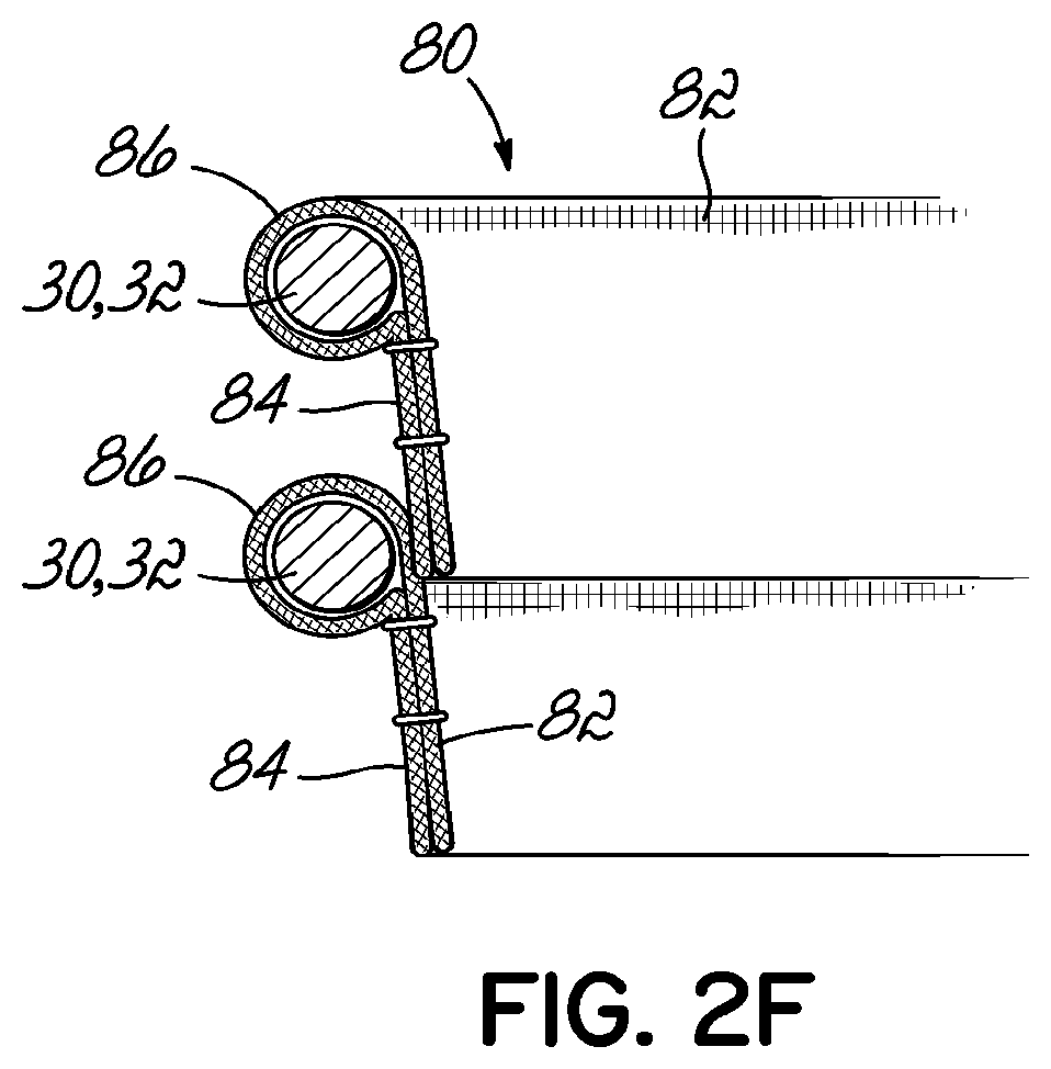 Patent US11793630 Figure 4 – Apparatus and methods for implanting a replacement heart valve