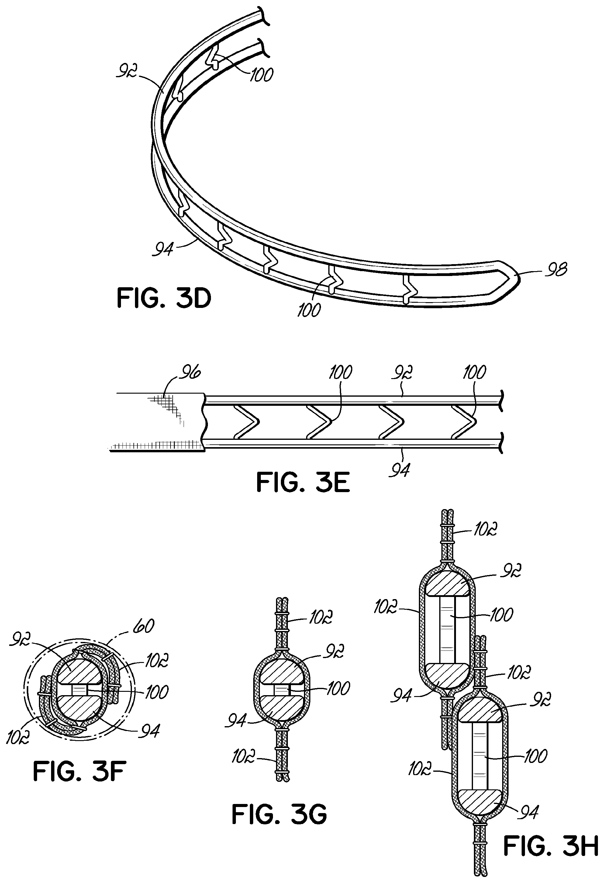 Patent US11793630 Figure 6 – Apparatus and methods for implanting a replacement heart valve