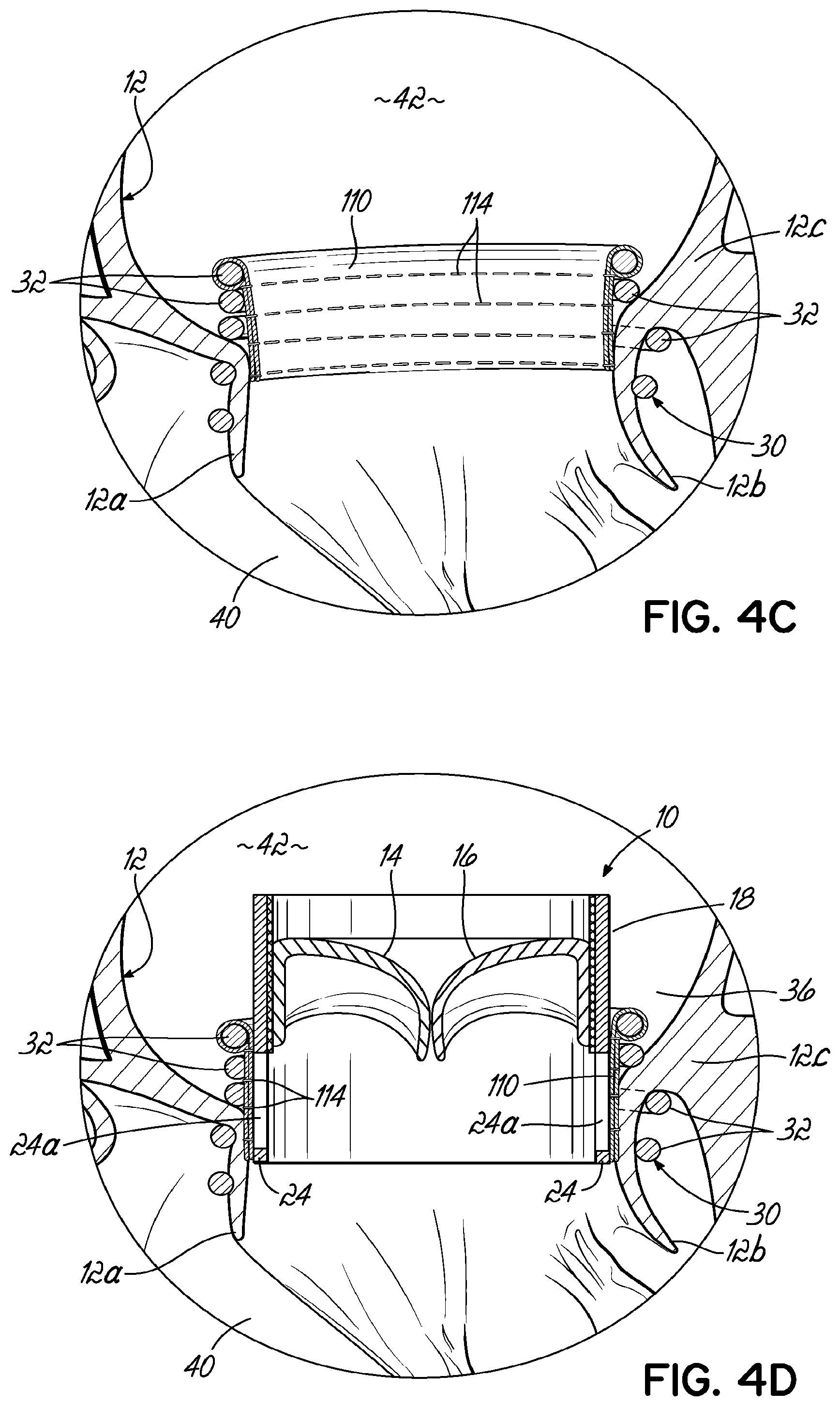 Patent US11793630 Figure 8 – Apparatus and methods for implanting a replacement heart valve