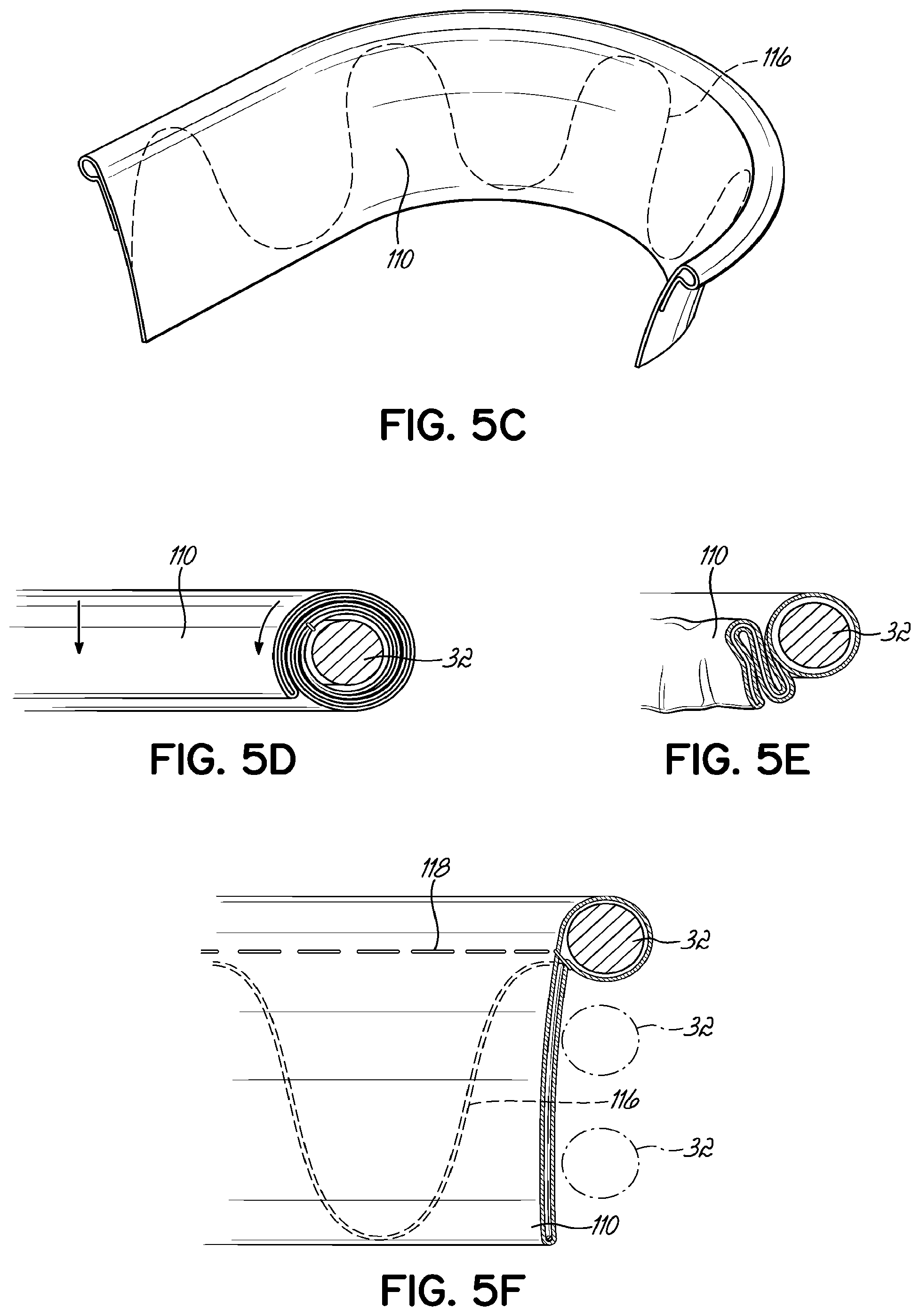 Patent US11793630 Figure 10 – Apparatus and methods for implanting a replacement heart valve