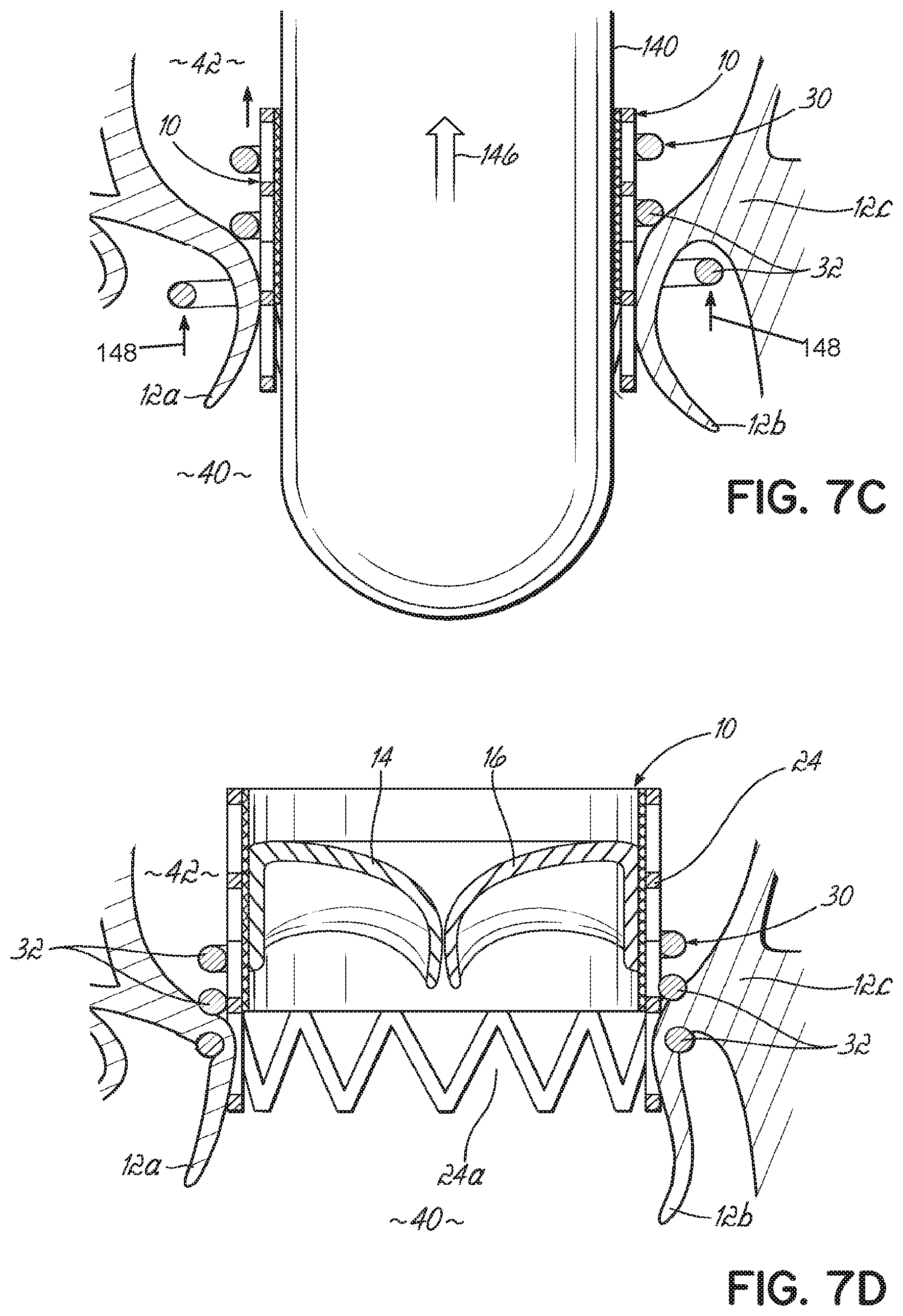 Patent US11793630 Figure 14 – Apparatus and methods for implanting a replacement heart valve