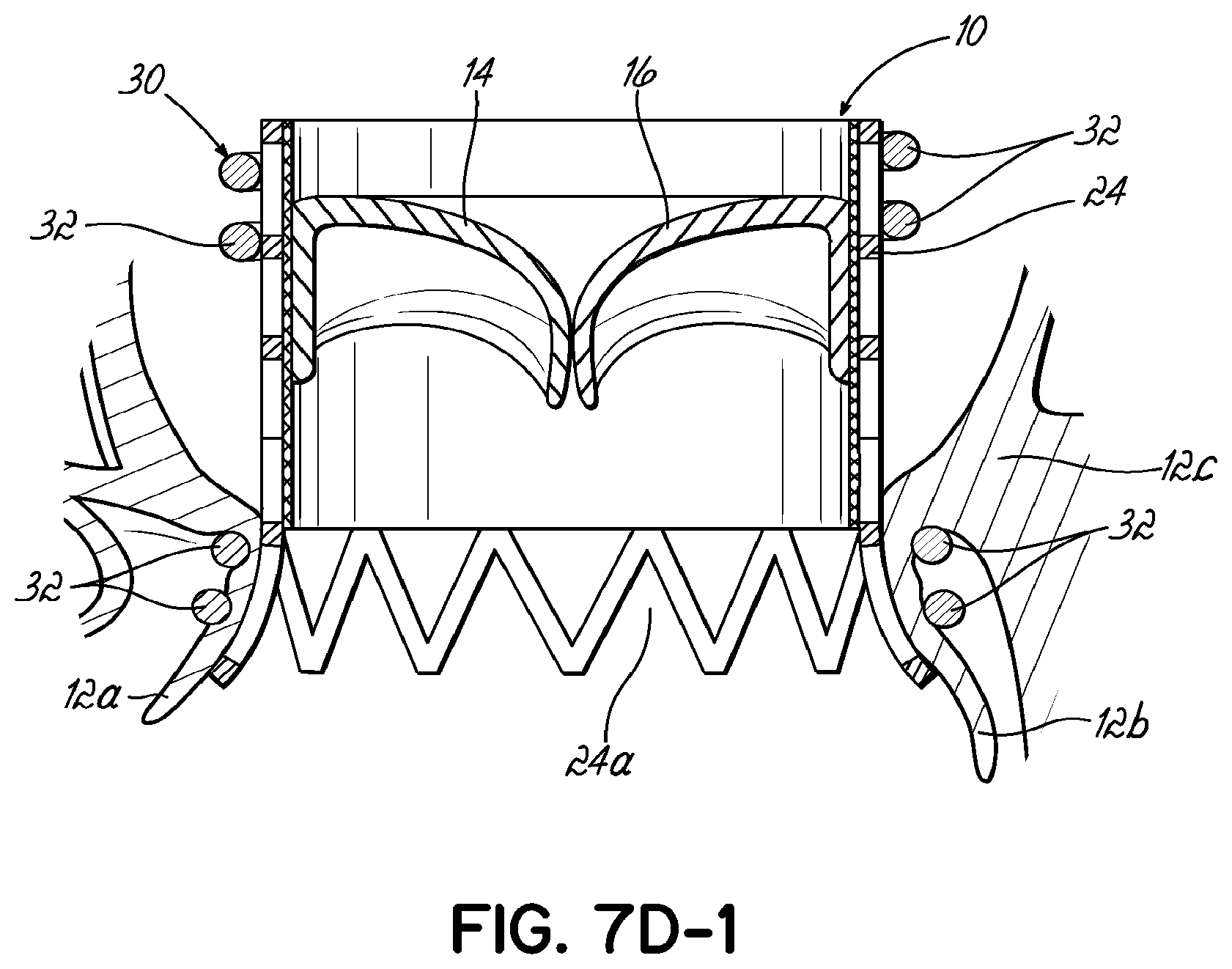 Patent US11793630 Figure 15 – Apparatus and methods for implanting a replacement heart valve