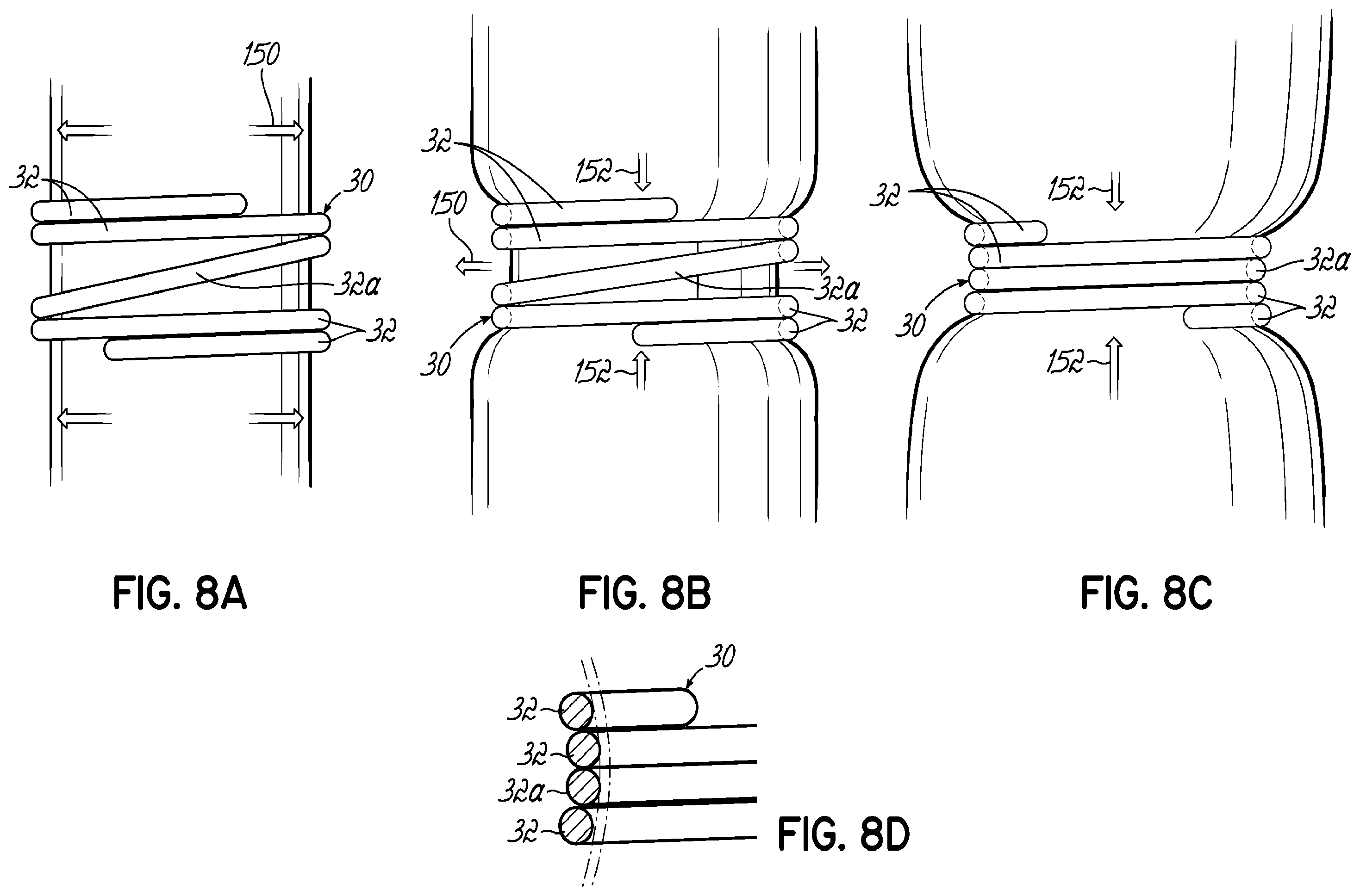 Patent US11793630 Figure 16 – Apparatus and methods for implanting a replacement heart valve