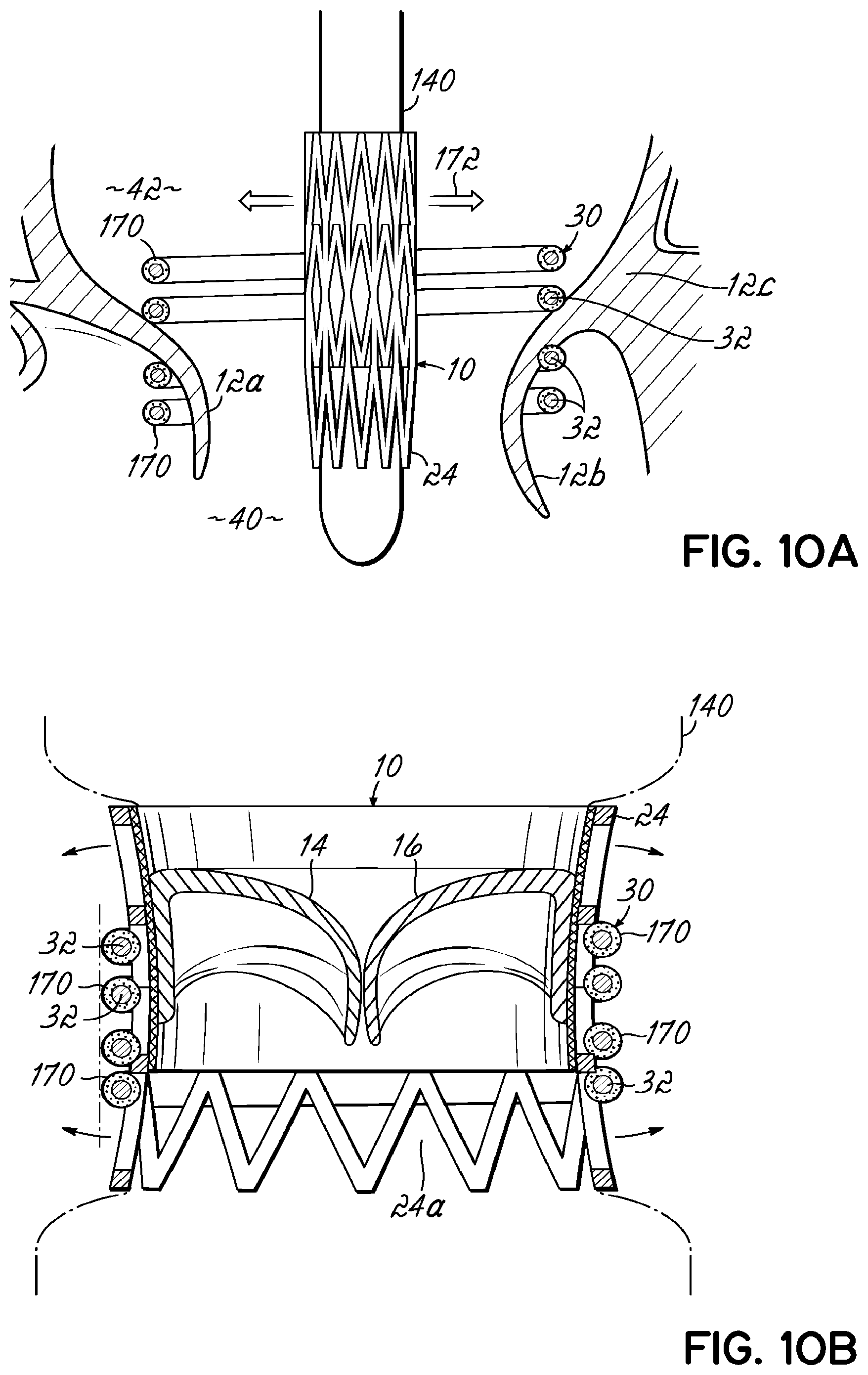 Patent US11793630 Figure 18 – Apparatus and methods for implanting a replacement heart valve