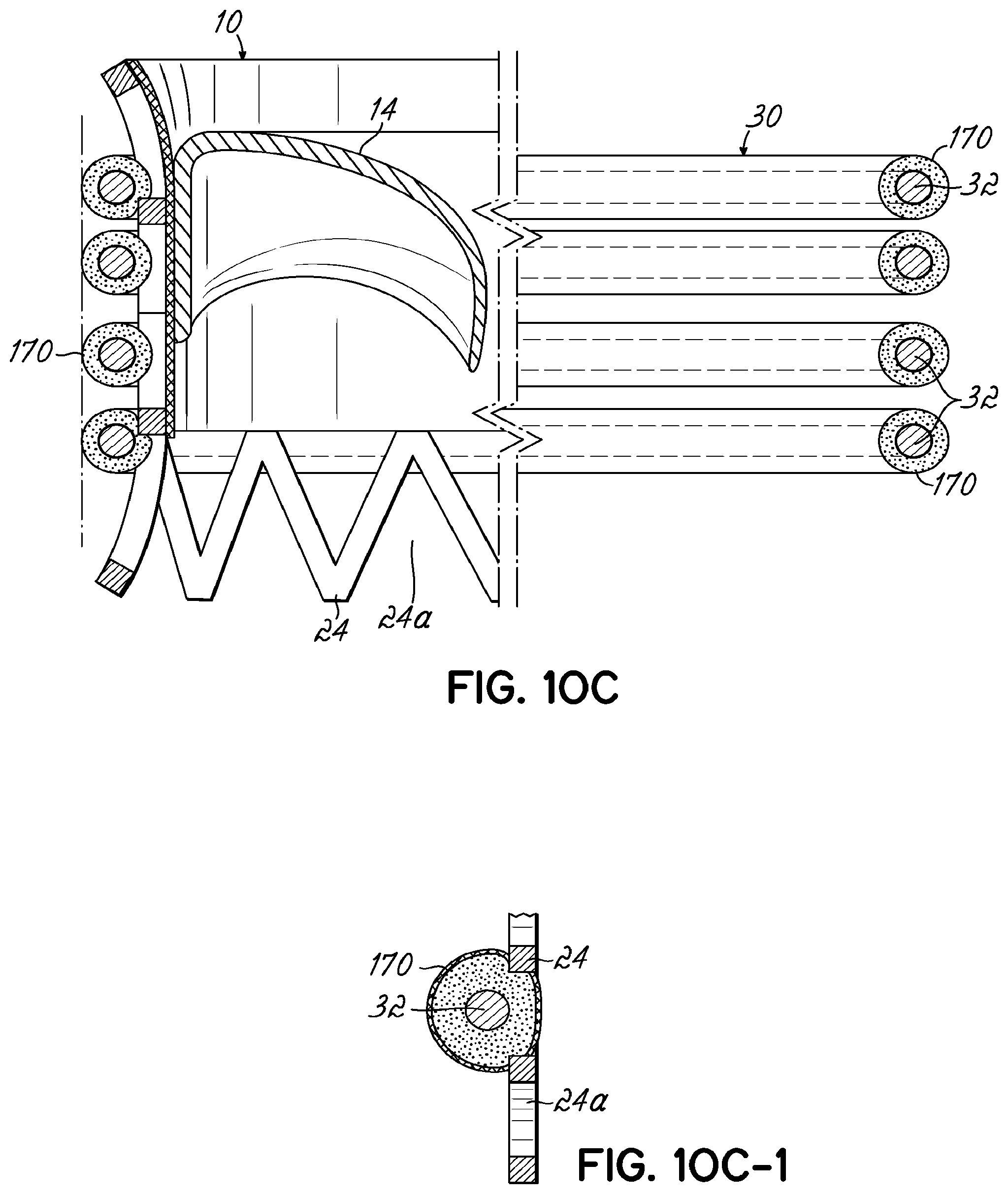Patent US11793630 Figure 19 – Apparatus and methods for implanting a replacement heart valve