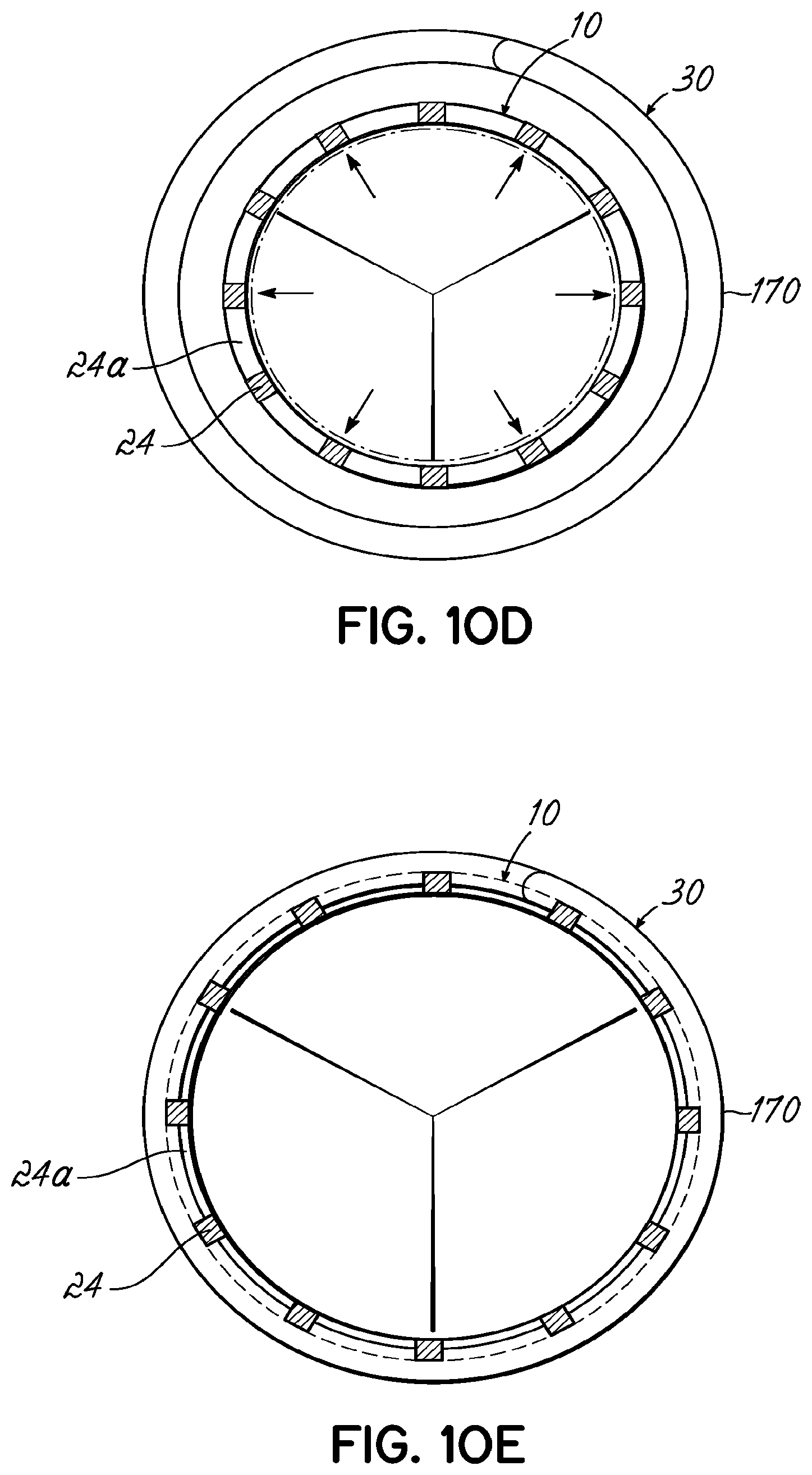 Patent US11793630 Figure 20 – Apparatus and methods for implanting a replacement heart valve