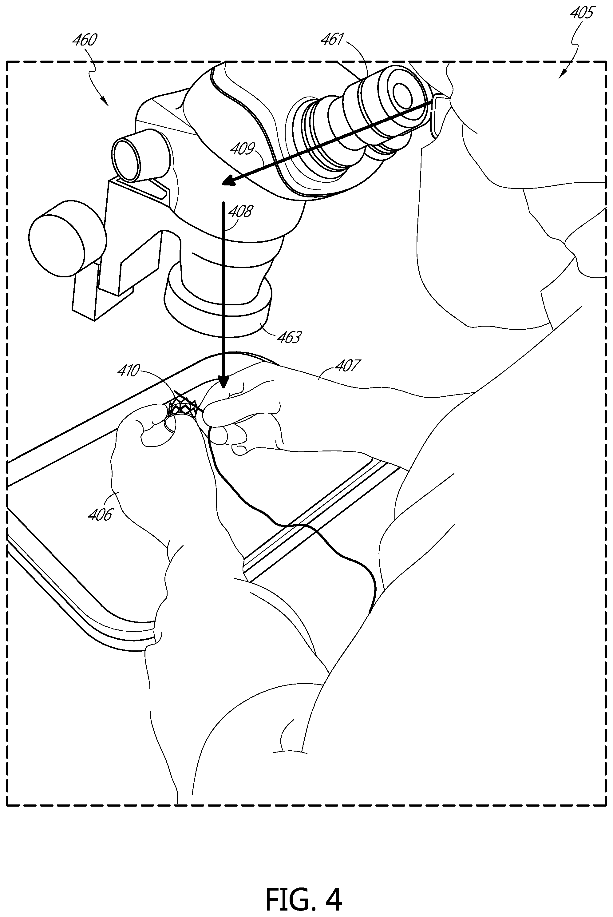 Patent US11793631 Figure 4 – Devices for assisting with heart valve manufacturing