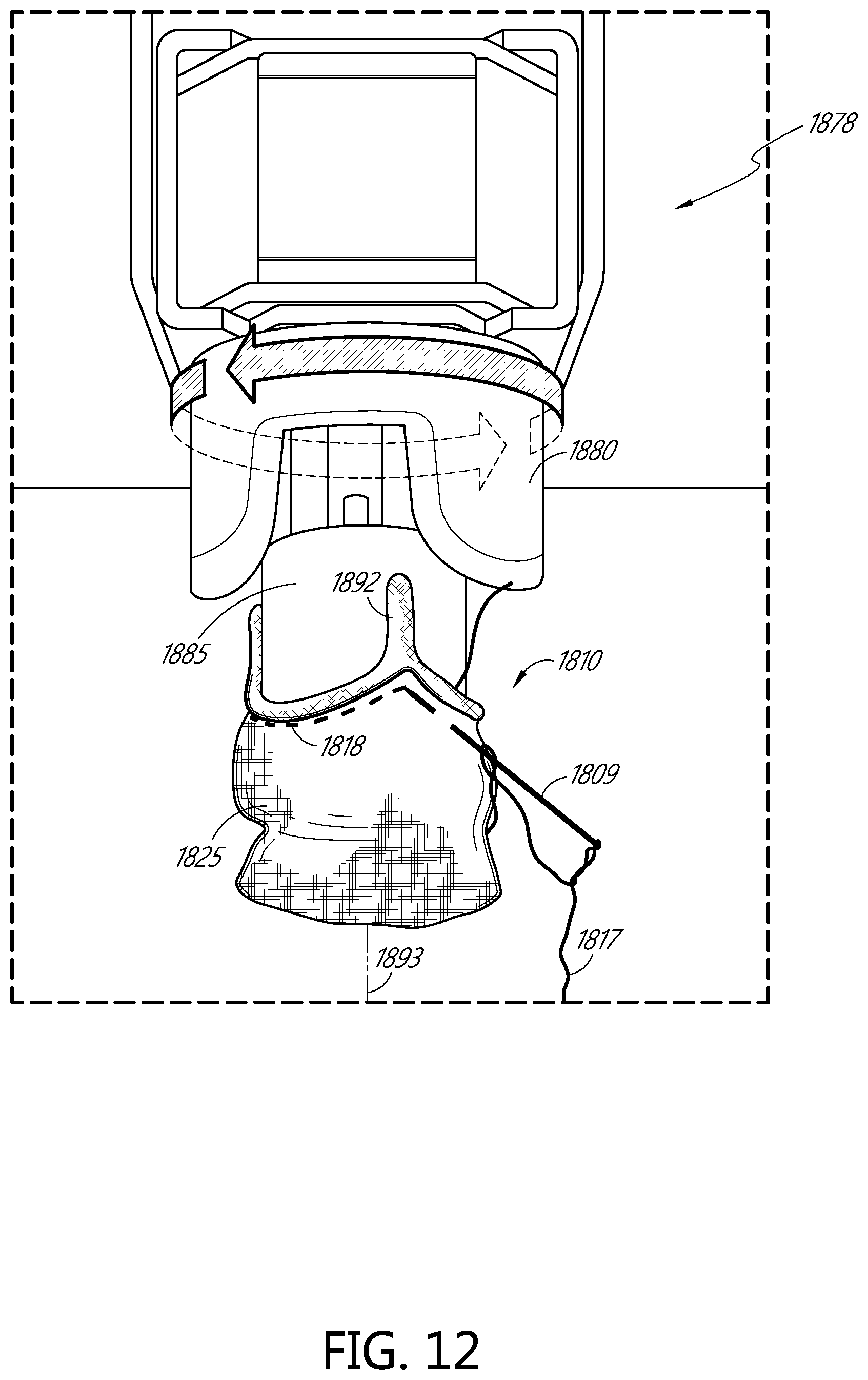 Patent US11793631 Figure 15 – Devices for assisting with heart valve manufacturing