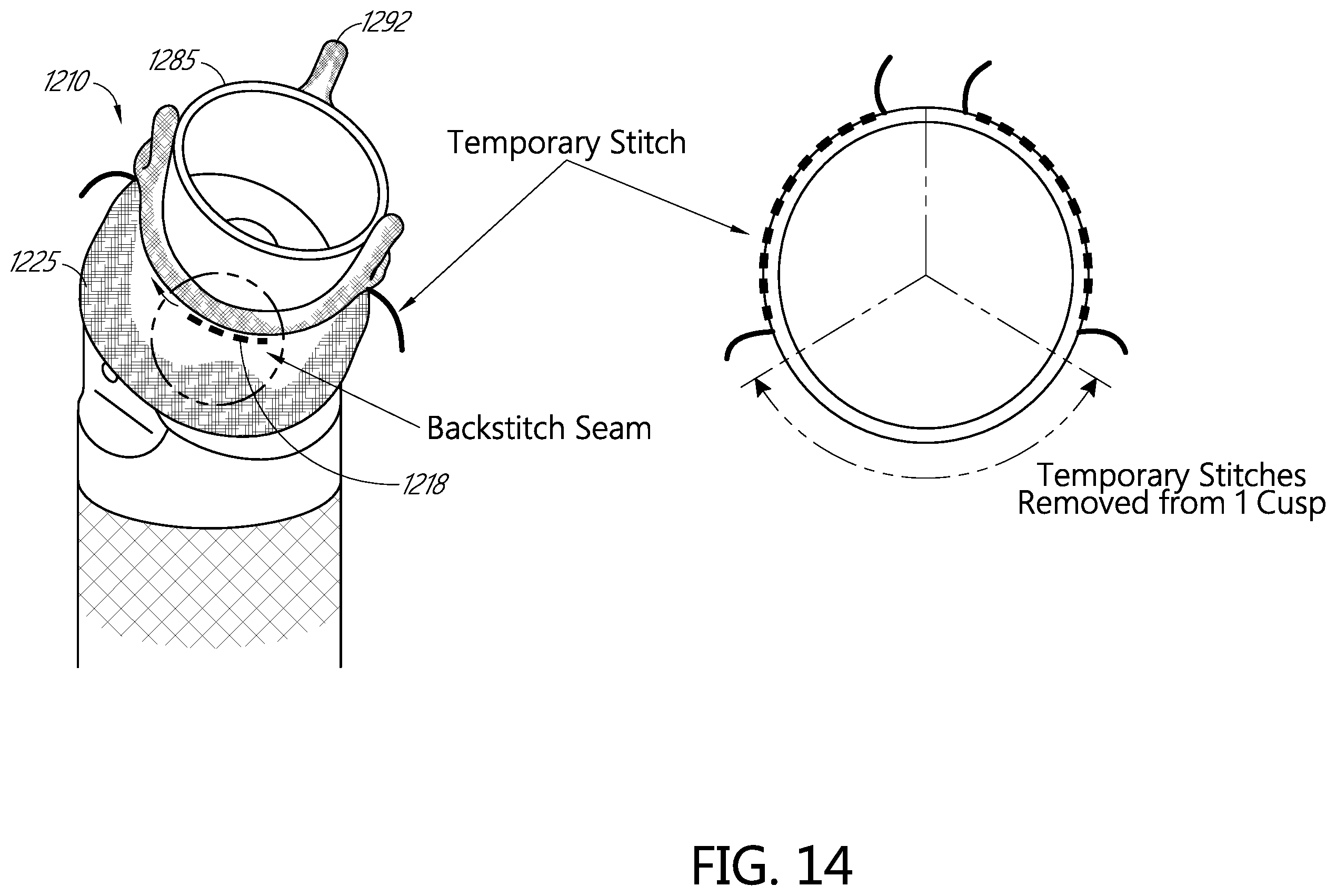 Patent US11793631 Figure 17 – Devices for assisting with heart valve manufacturing