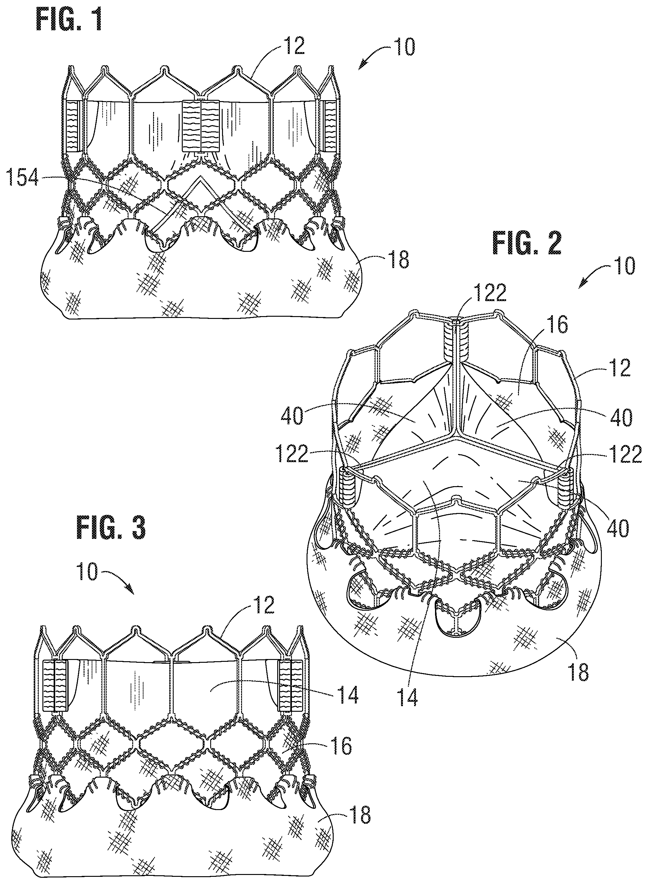 Patent US11793632 Figure 1 – Prosthetic heart valve