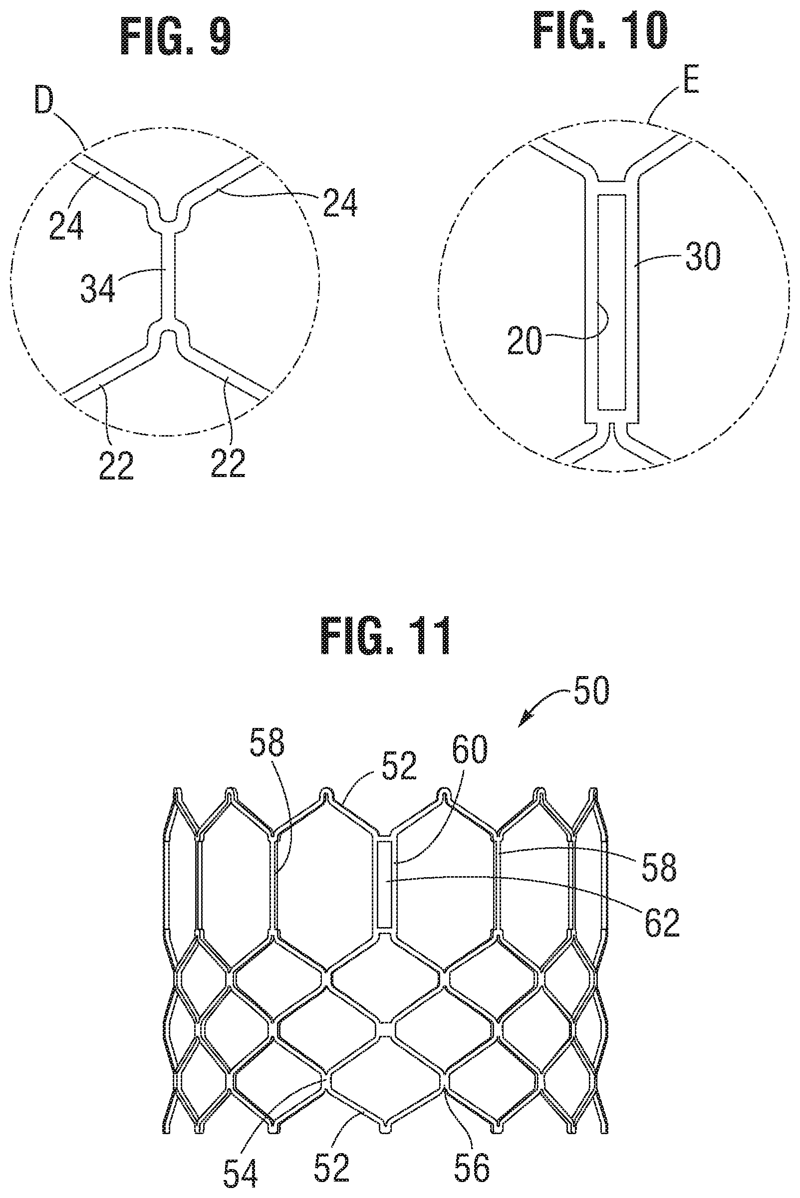 Patent US11793632 Figure 3 – Prosthetic heart valve