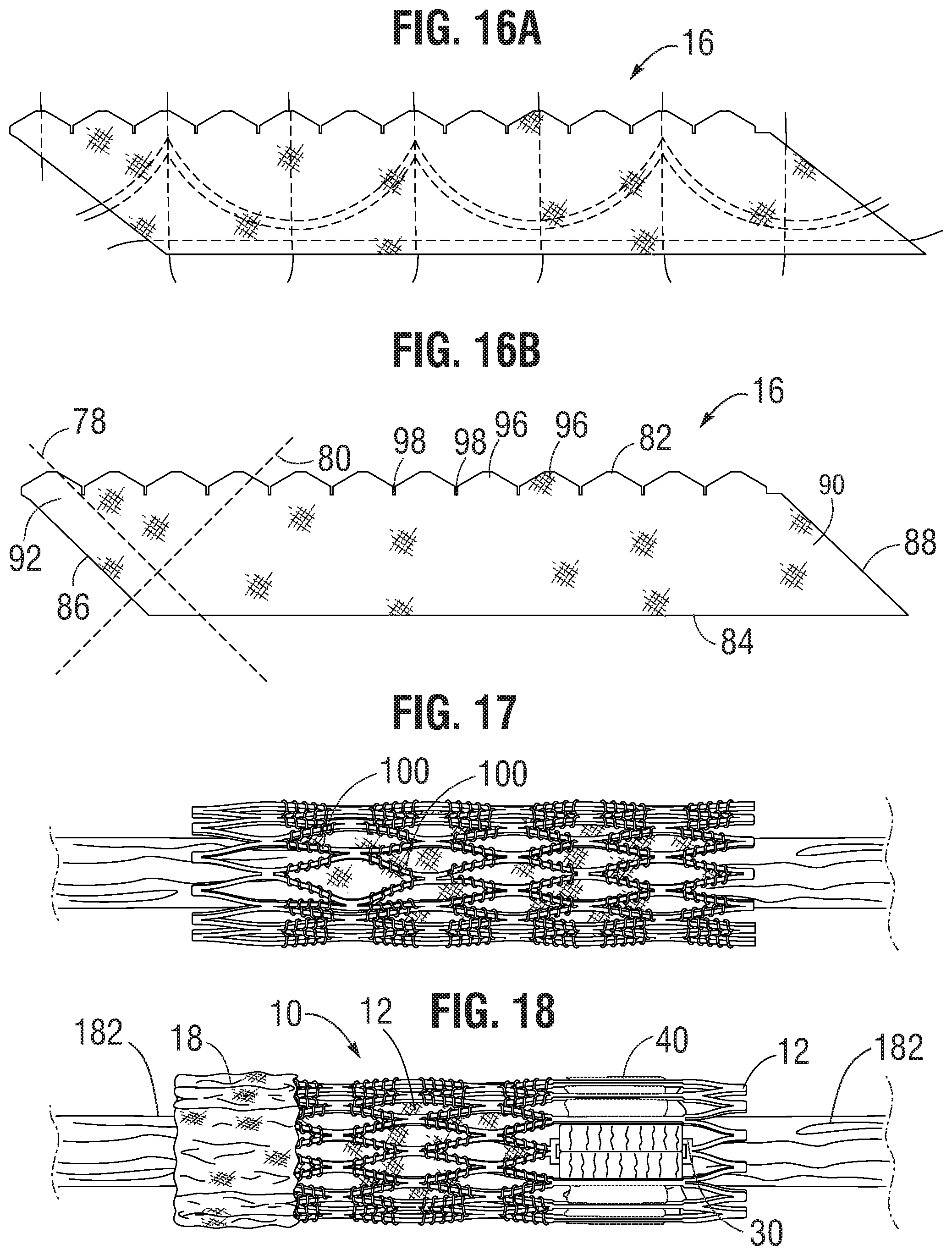 Patent US11793632 Figure 5 – Prosthetic heart valve