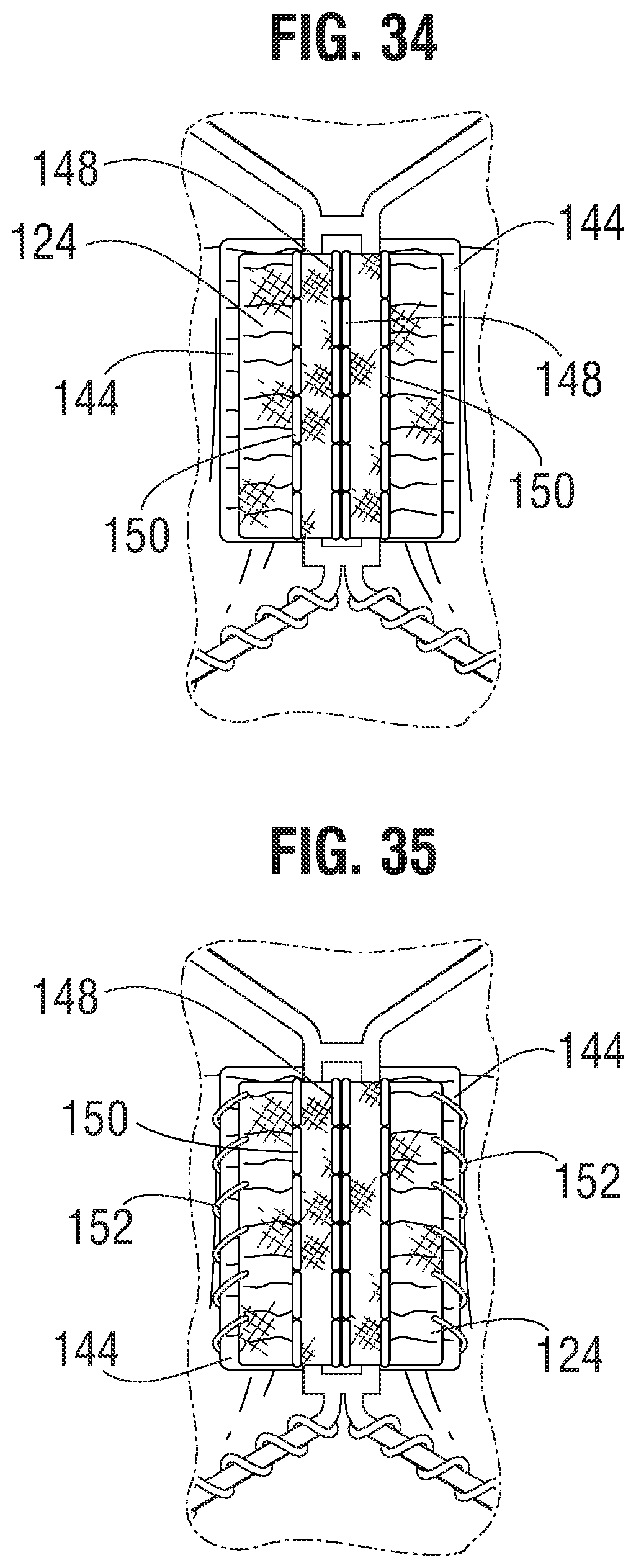 Patent US11793632 Figure 12 – Prosthetic heart valve