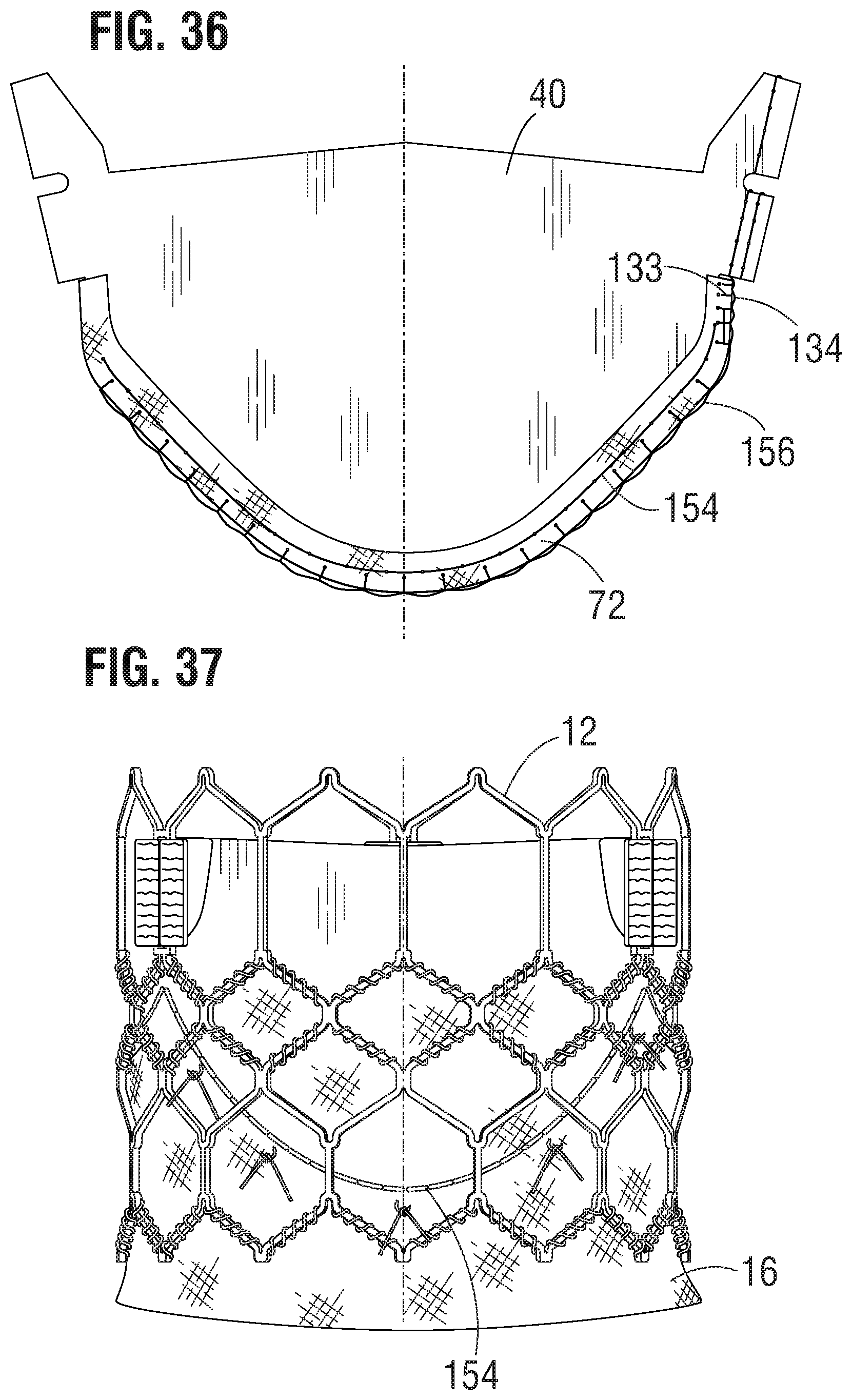 Patent US11793632 Figure 13 – Prosthetic heart valve