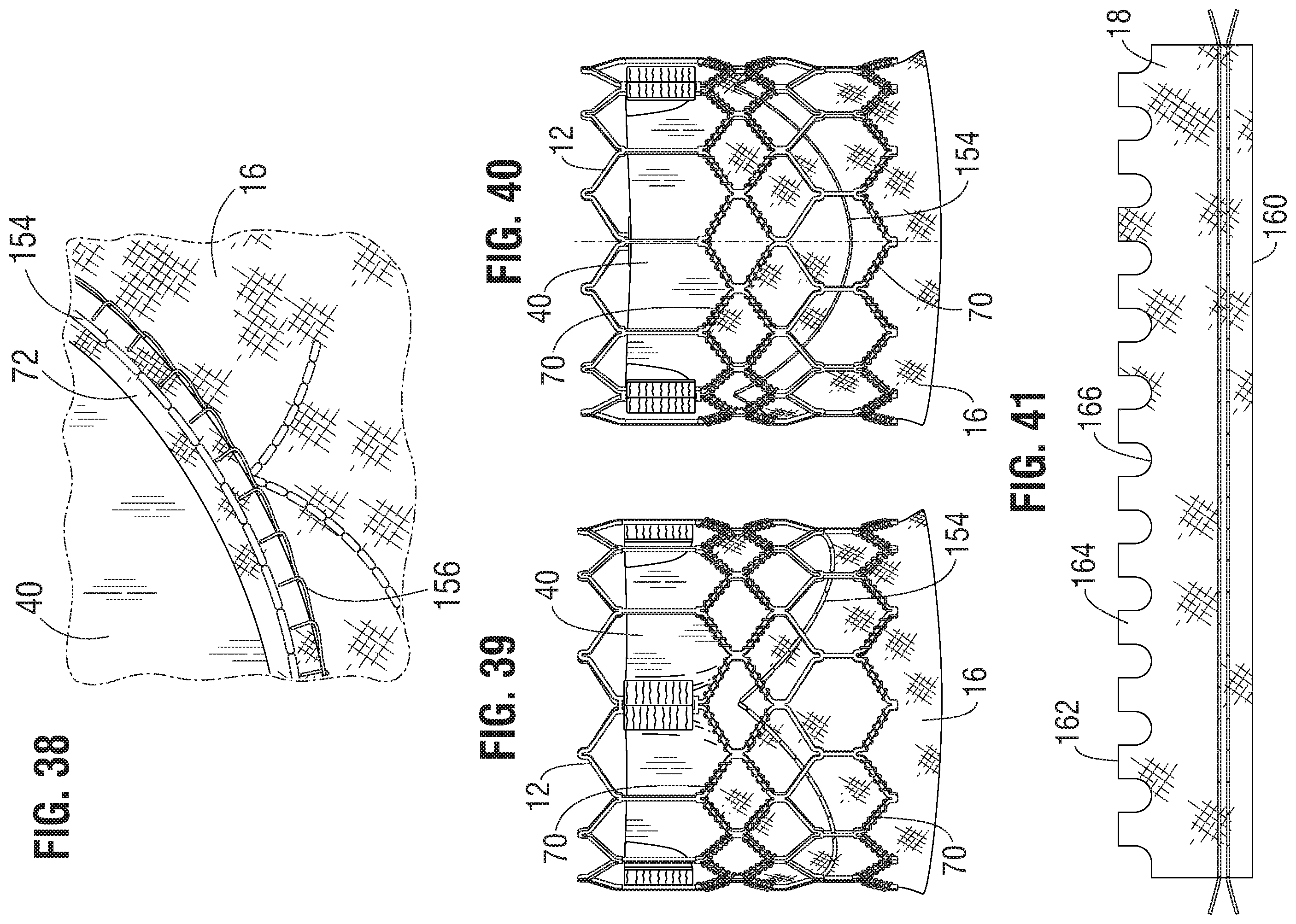 Patent US11793632 Figure 14 – Prosthetic heart valve