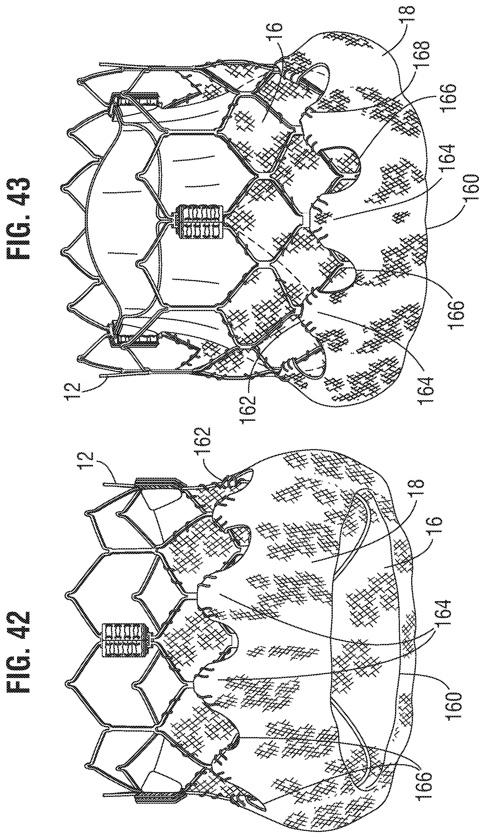 Patent US11793632 Figure 15 – Prosthetic heart valve