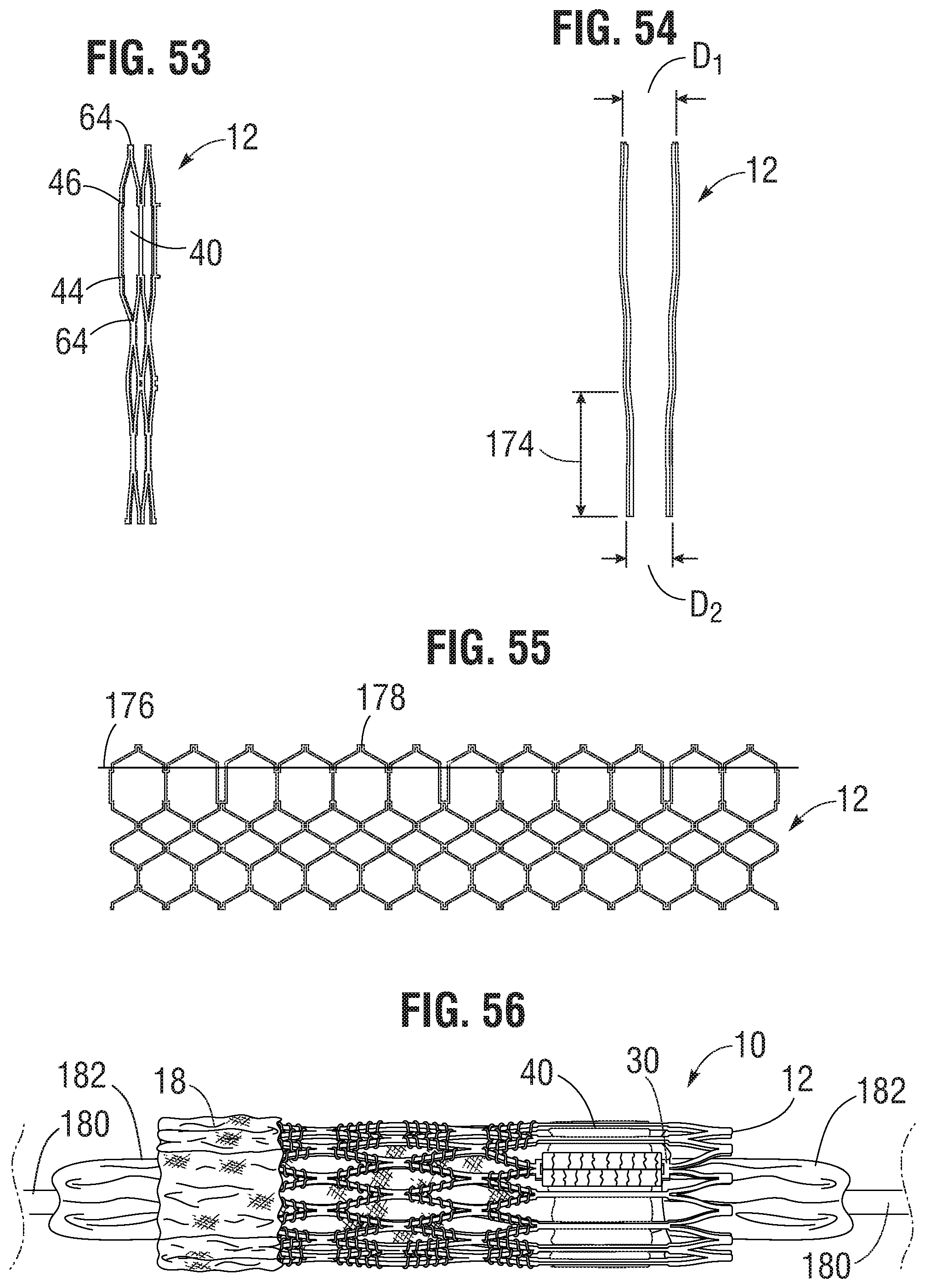 Patent US11793632 Figure 18 – Prosthetic heart valve