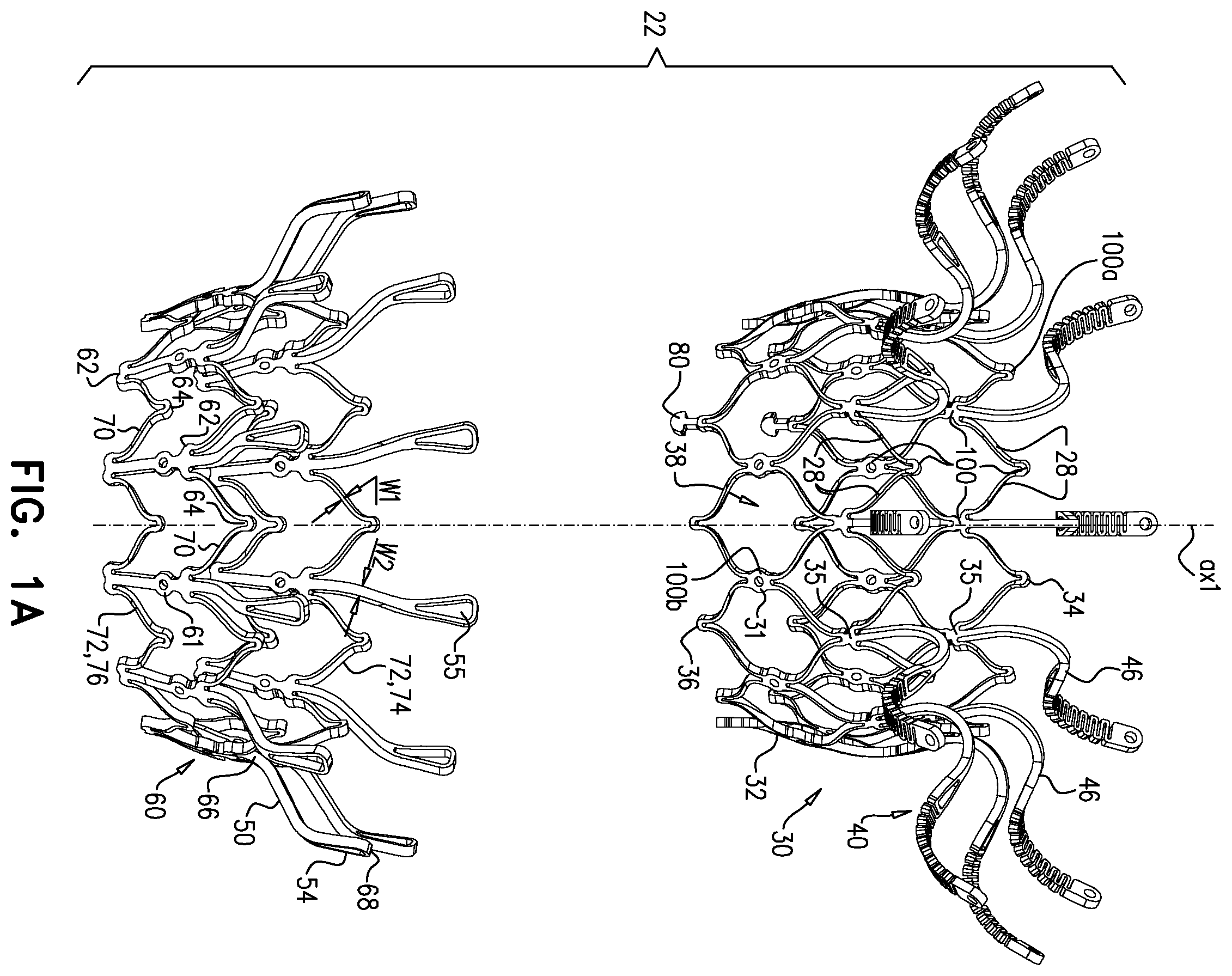 Patent US11793633 Figure 1 – Prosthetic heart valve