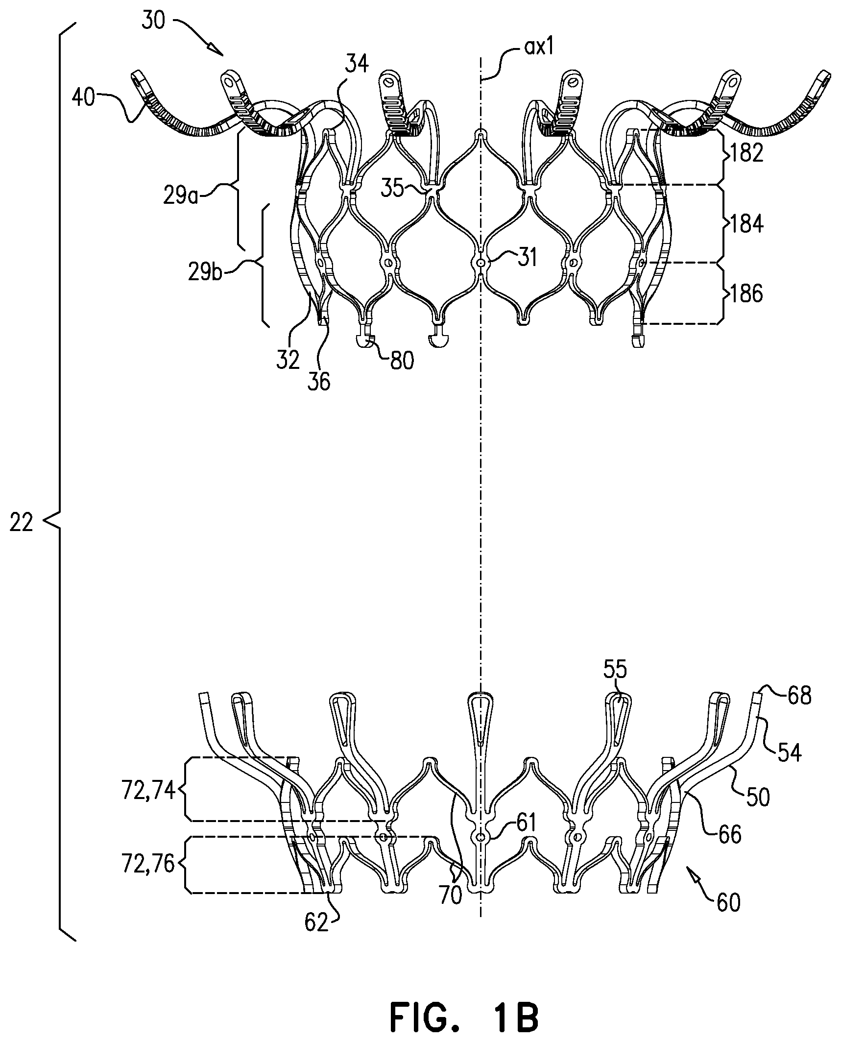Patent US11793633 Figure 2 – Prosthetic heart valve