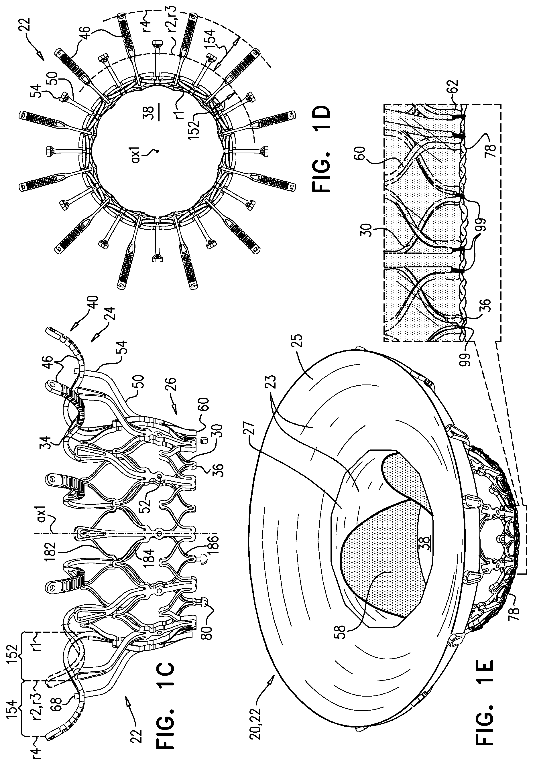 Patent US11793633 Figure 3 – Prosthetic heart valve