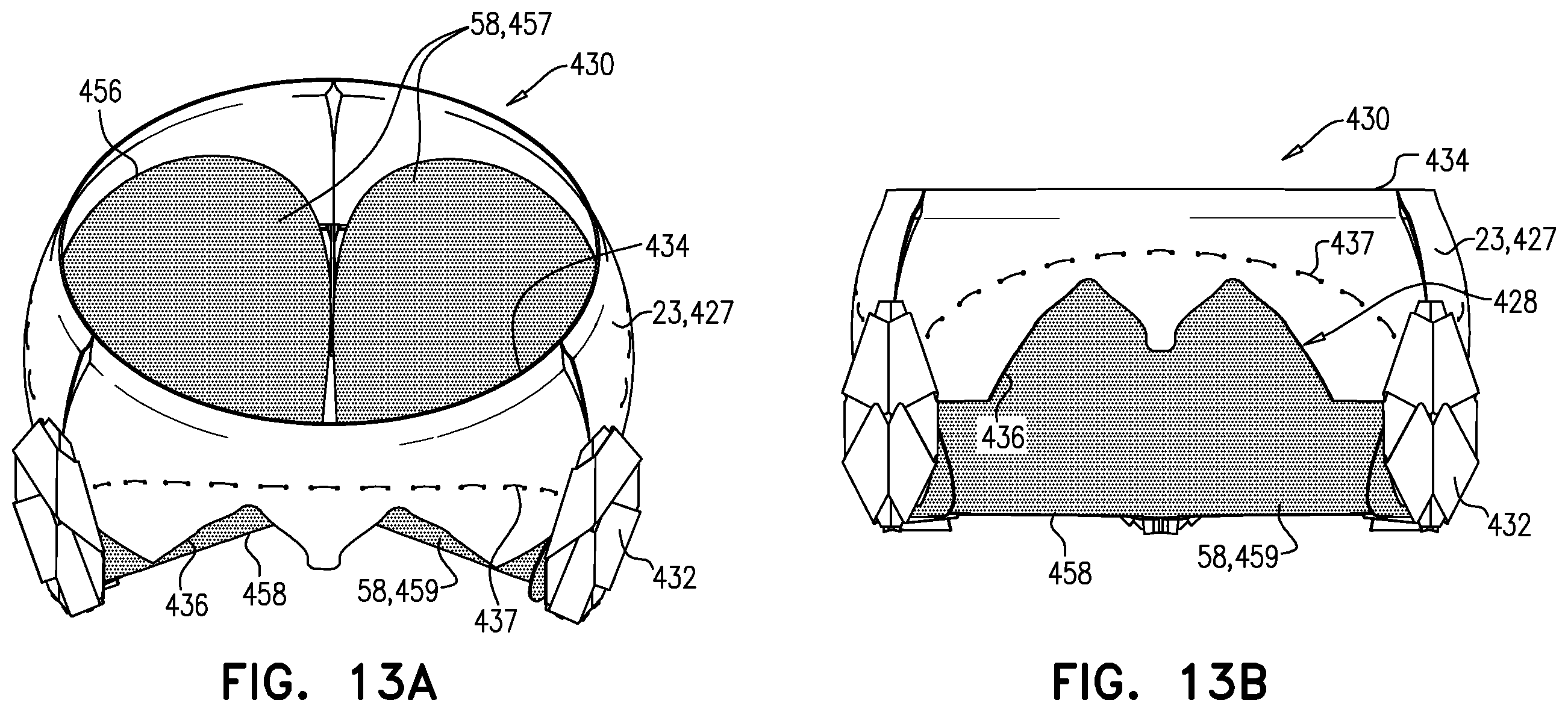 Patent US11793633 Figure 17 – Prosthetic heart valve