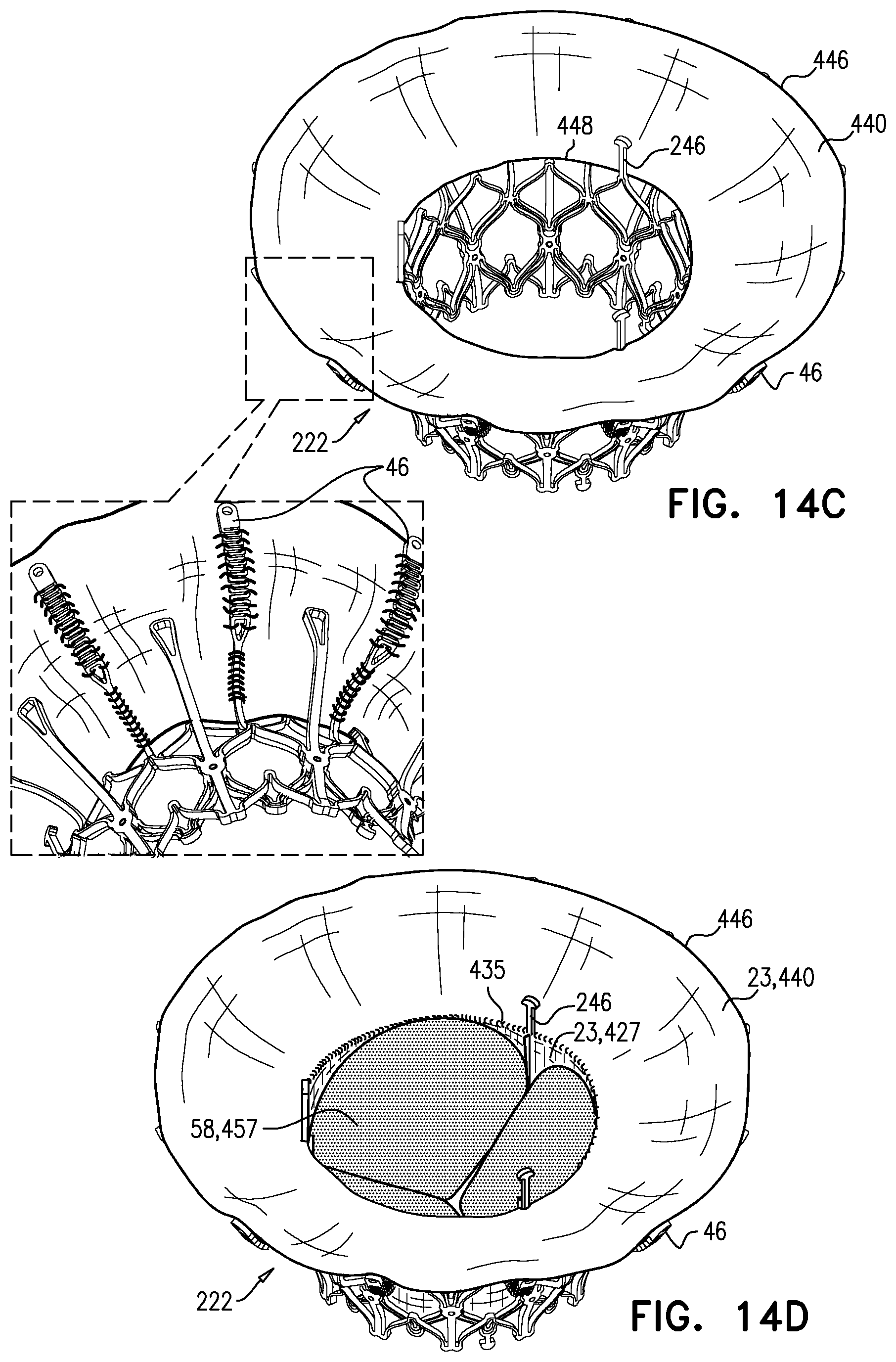 Patent US11793633 Figure 20 – Prosthetic heart valve