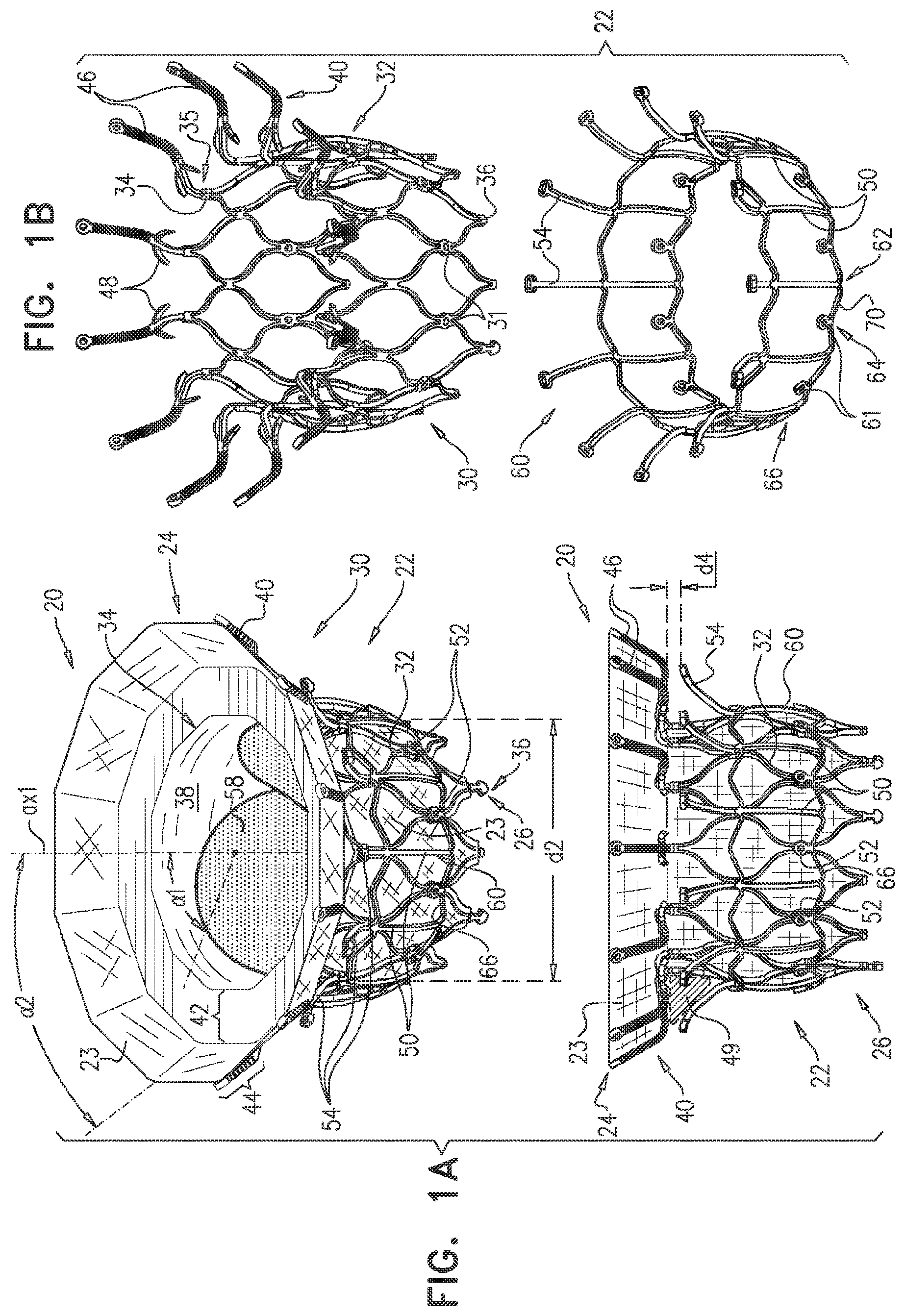 Patent US11793635 Figure 1 – Prosthetic valve with angularly offset frames