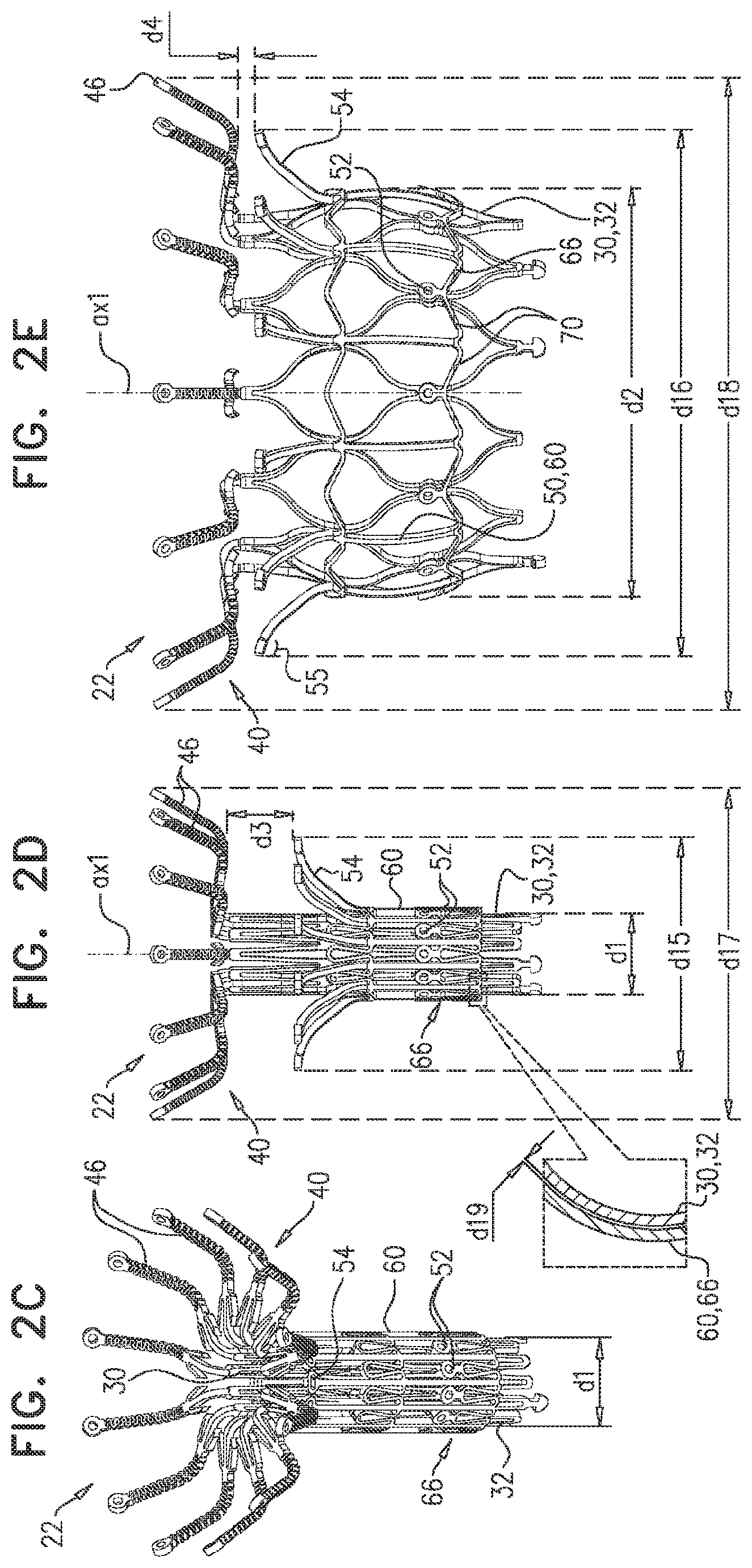 Patent US11793635 Figure 3 – Prosthetic valve with angularly offset frames