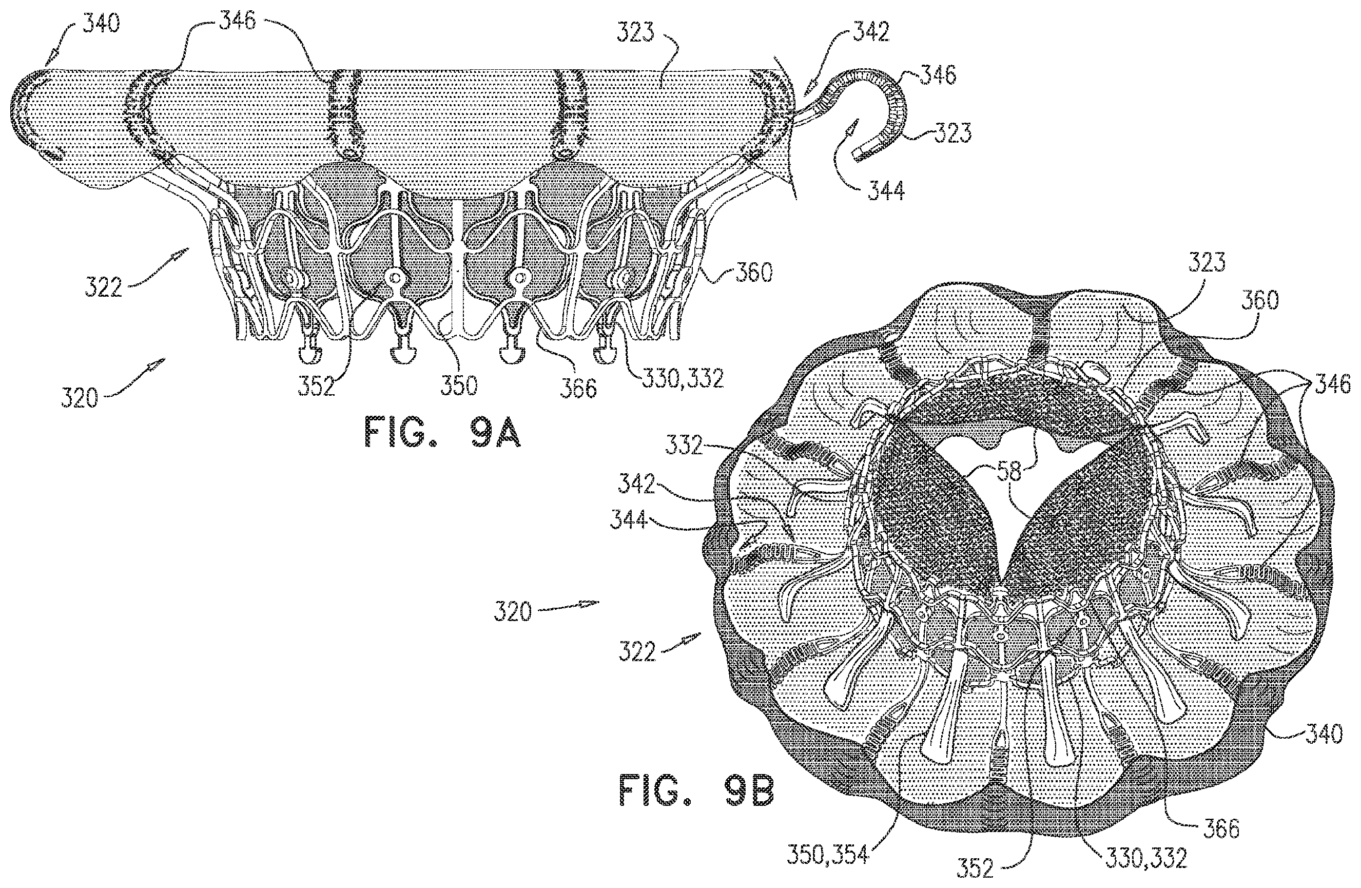 Patent US11793635 Figure 14 – Prosthetic valve with angularly offset frames